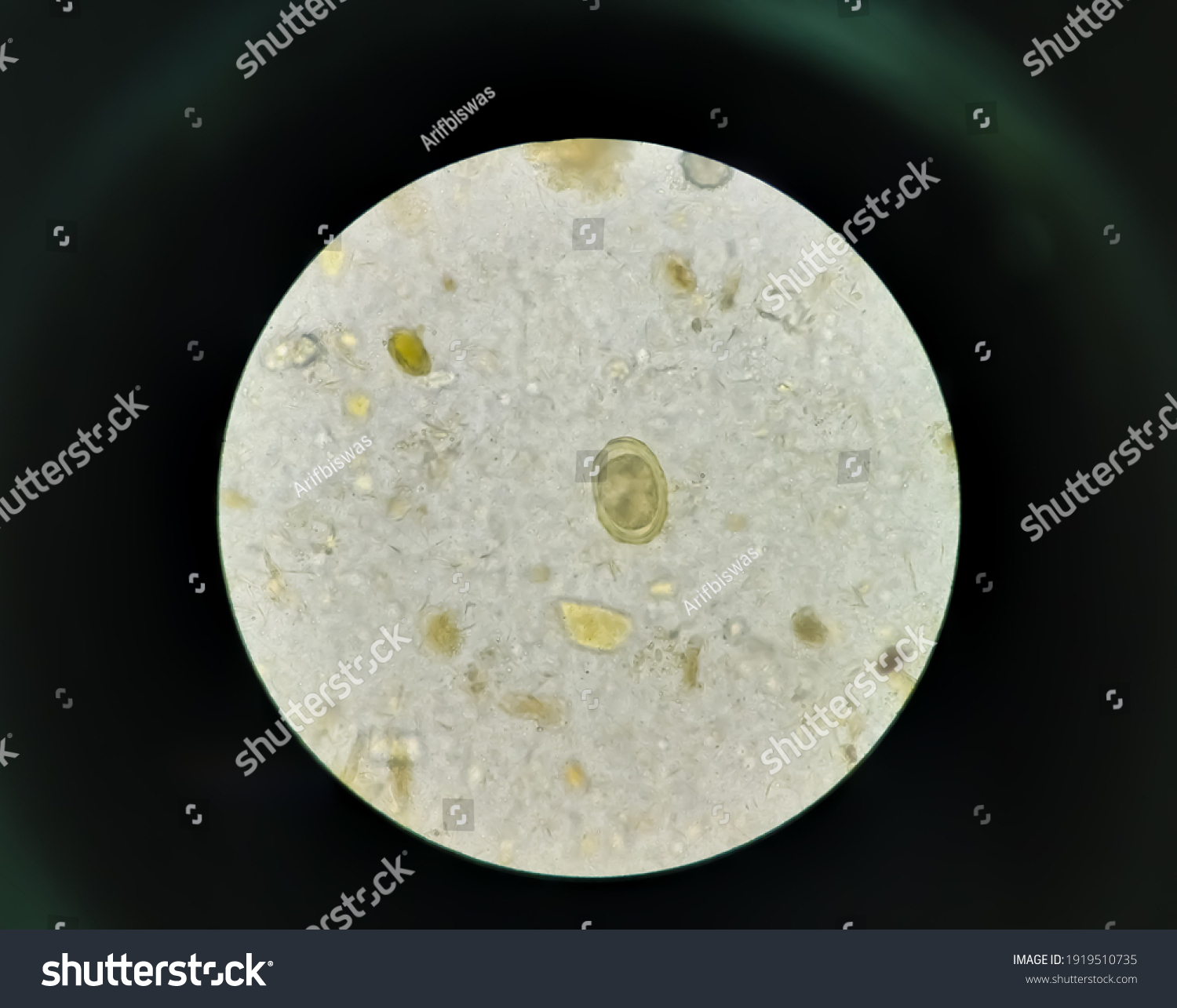 Stool Examination Under Direct Smear Microscope Stock Photo Edit Now 1919510735 Stool Examination Under Direct Smear Microscope Stock Photo Edit Now 1919510735