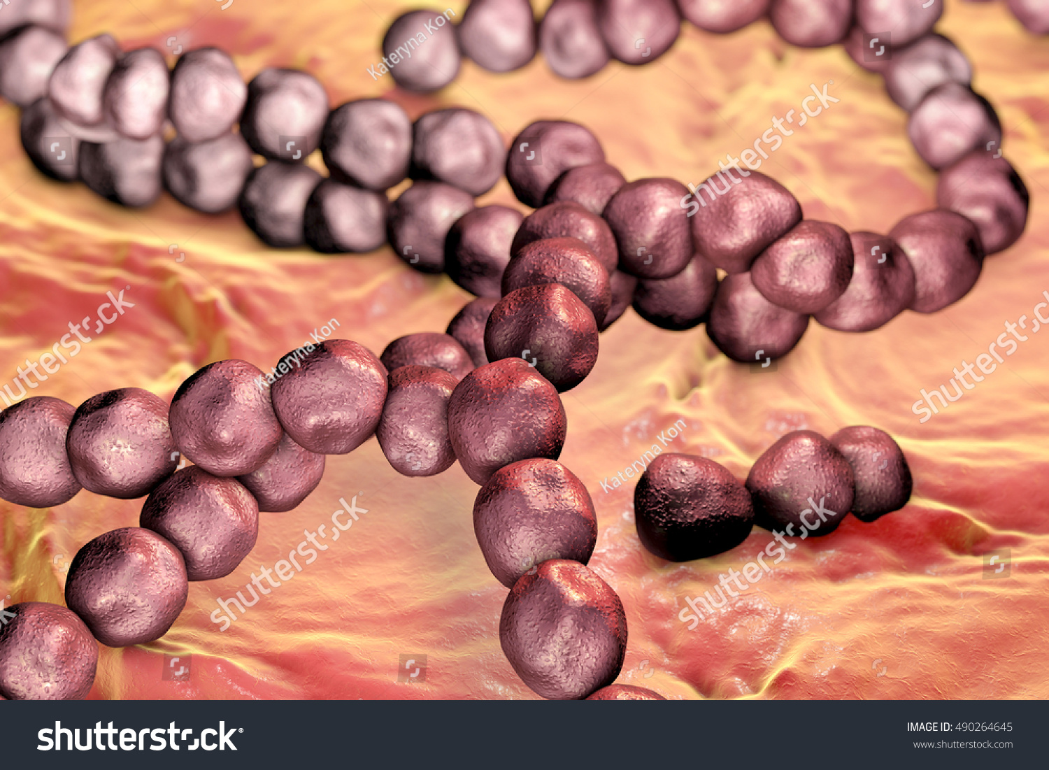 streptococcus-mutans-caries