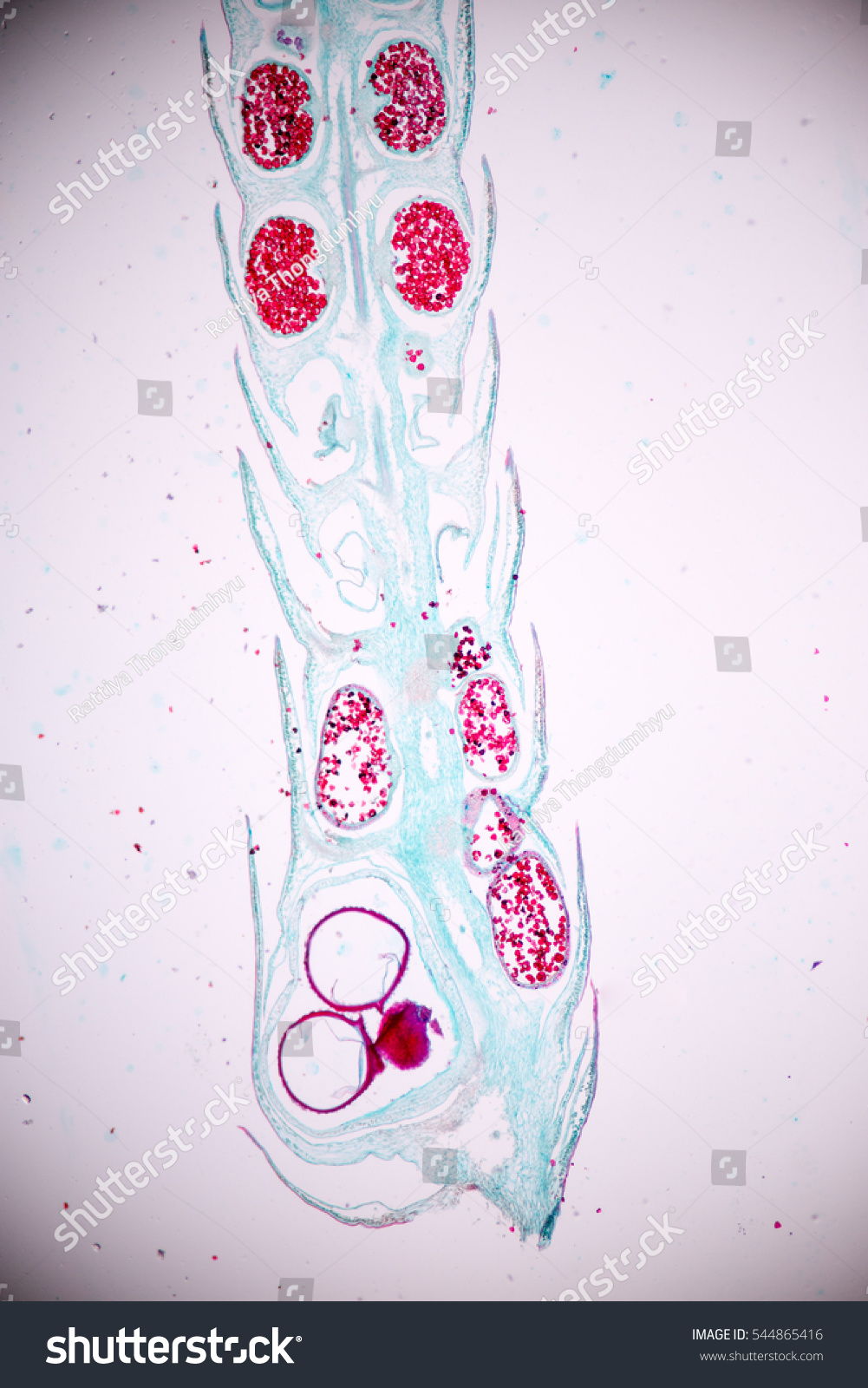 Strobilus Selaginella Under Microscope View Stock Photo (Edit Now ...