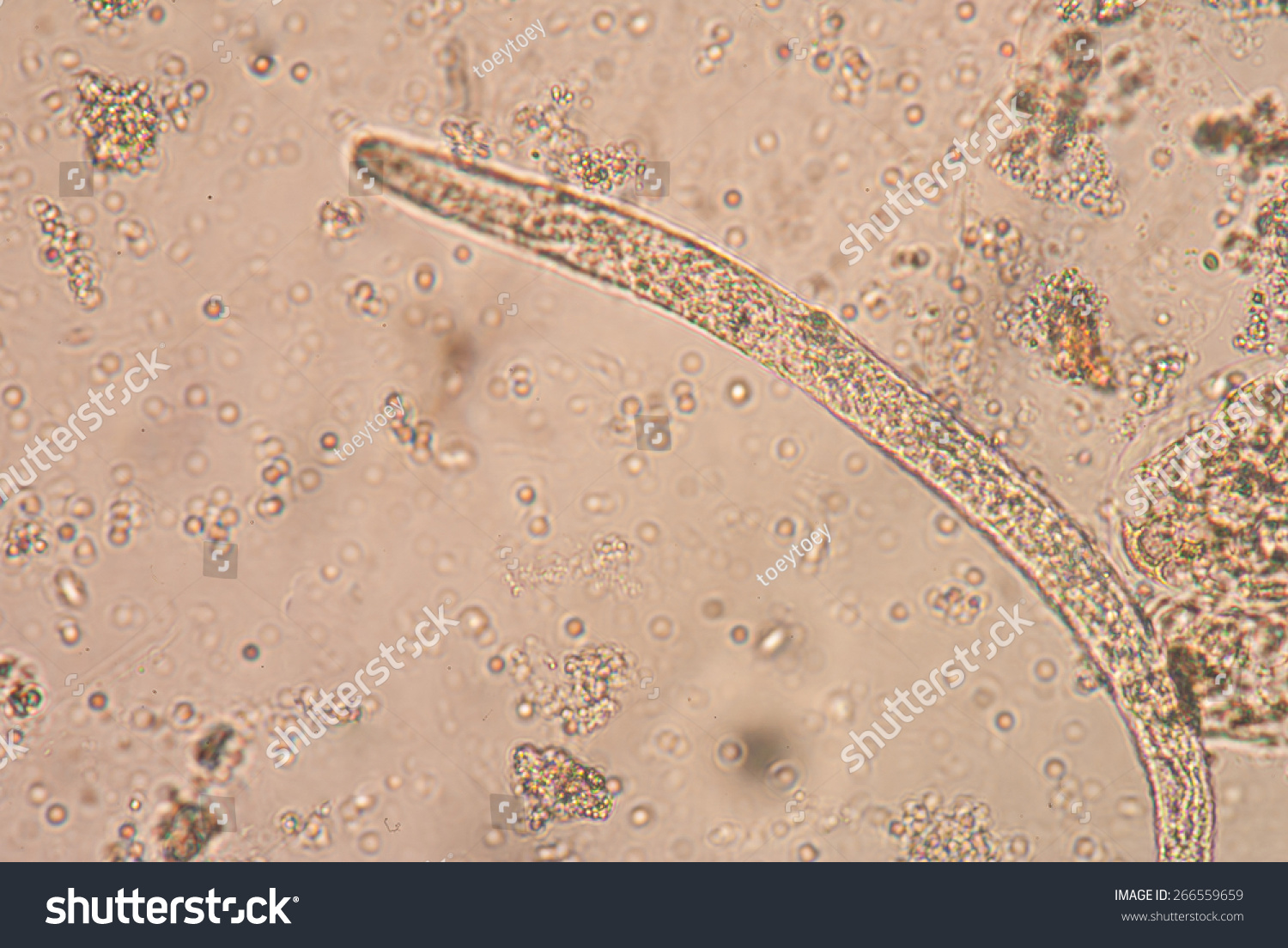 Strongyloides Stercoralis Human Parasitic Roundworm Causing Stock Photo ...