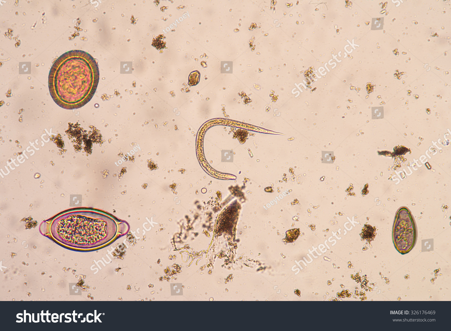 Strongyloides Stercoralis Is A Human Parasitic Roundworm Causing The ...