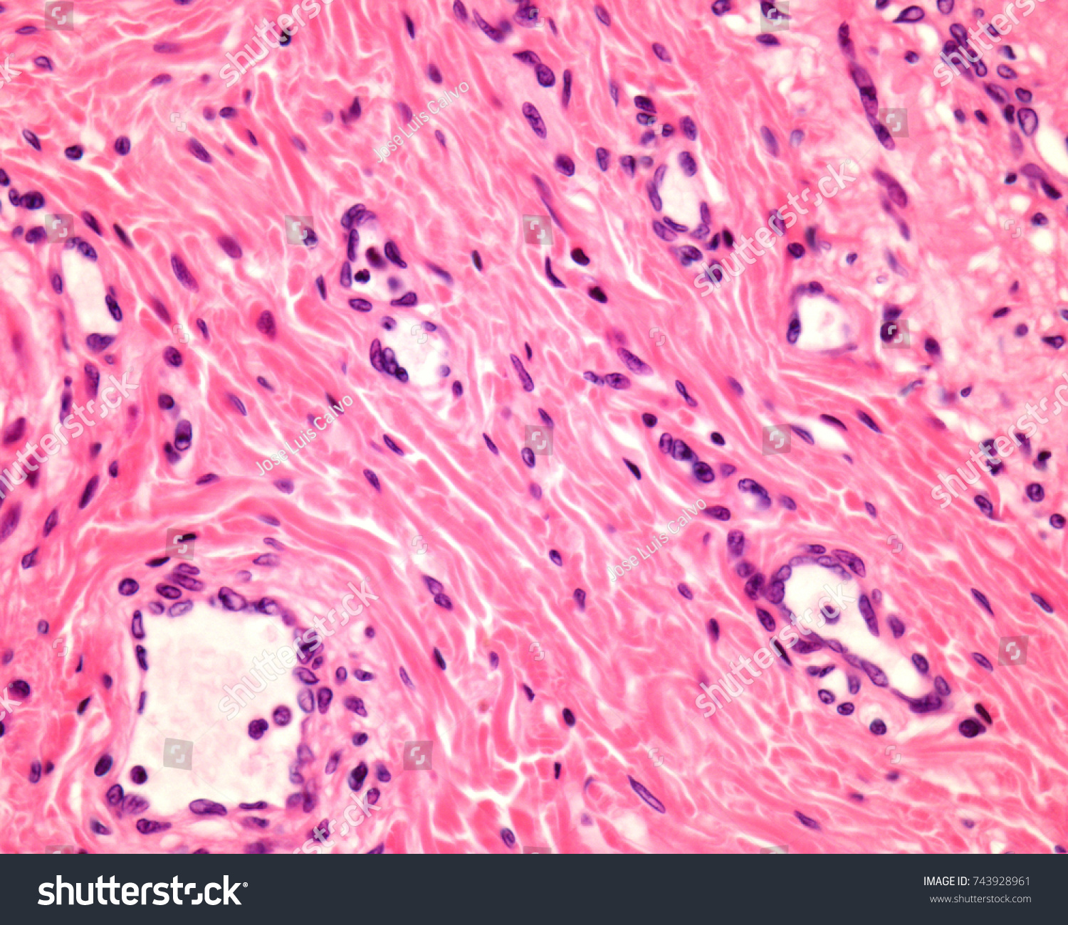 Submucosa Layer Esophagus Contains Connective Tissue Stock Photo ...