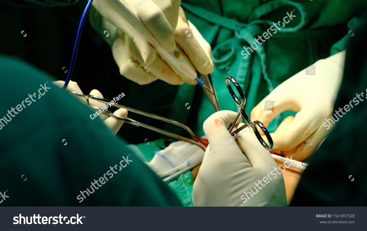 Surgeon Performing Inguinal Hernia Repair Hernioplasty Foto De Stock