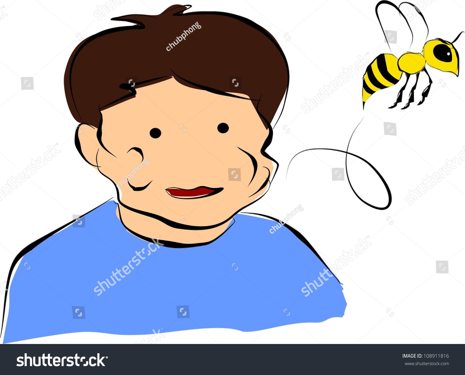 Swelling Bee Sting Stock Illustration 108911816 Shutterstock