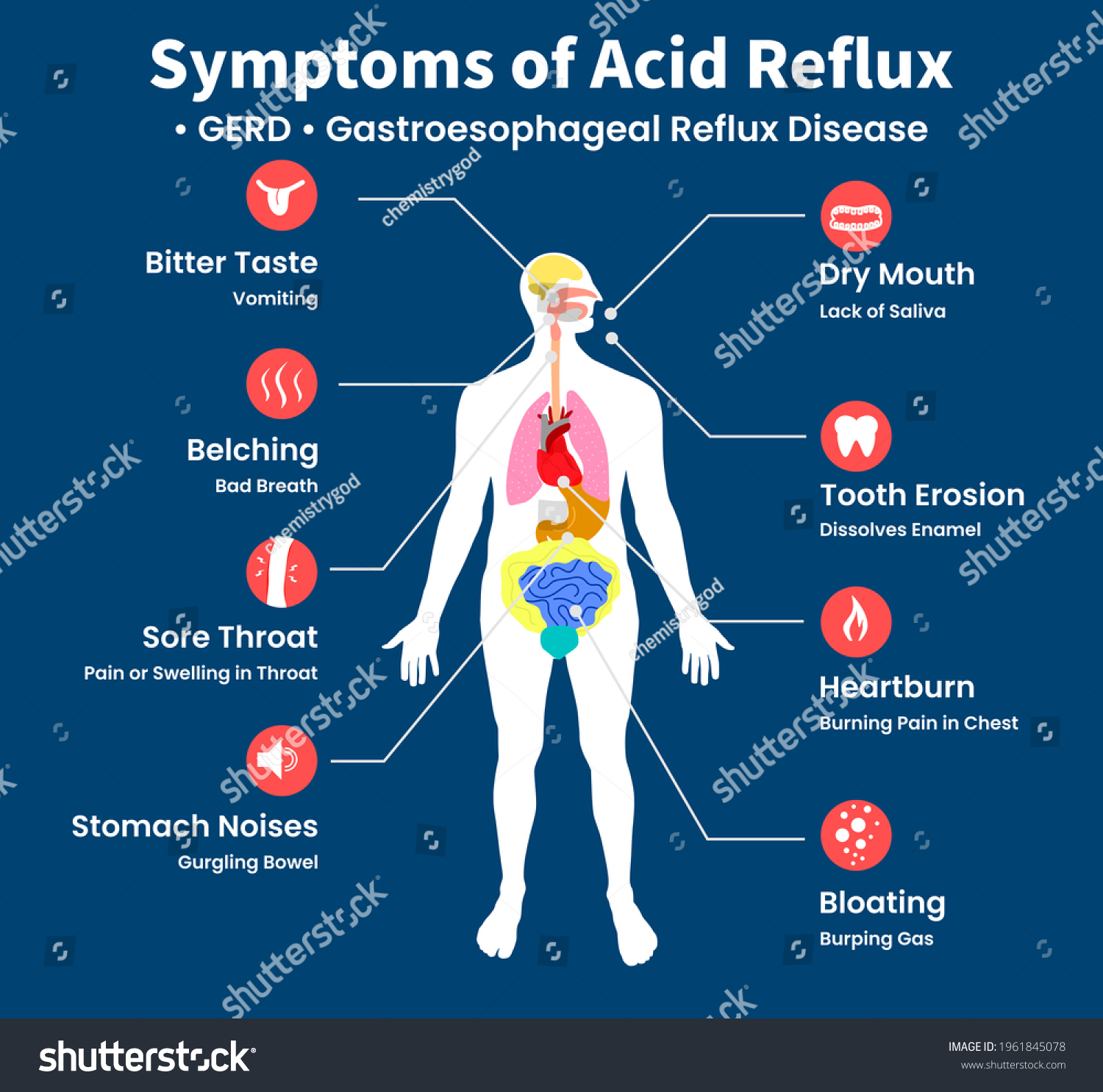 Reflux acid 4 Stages
