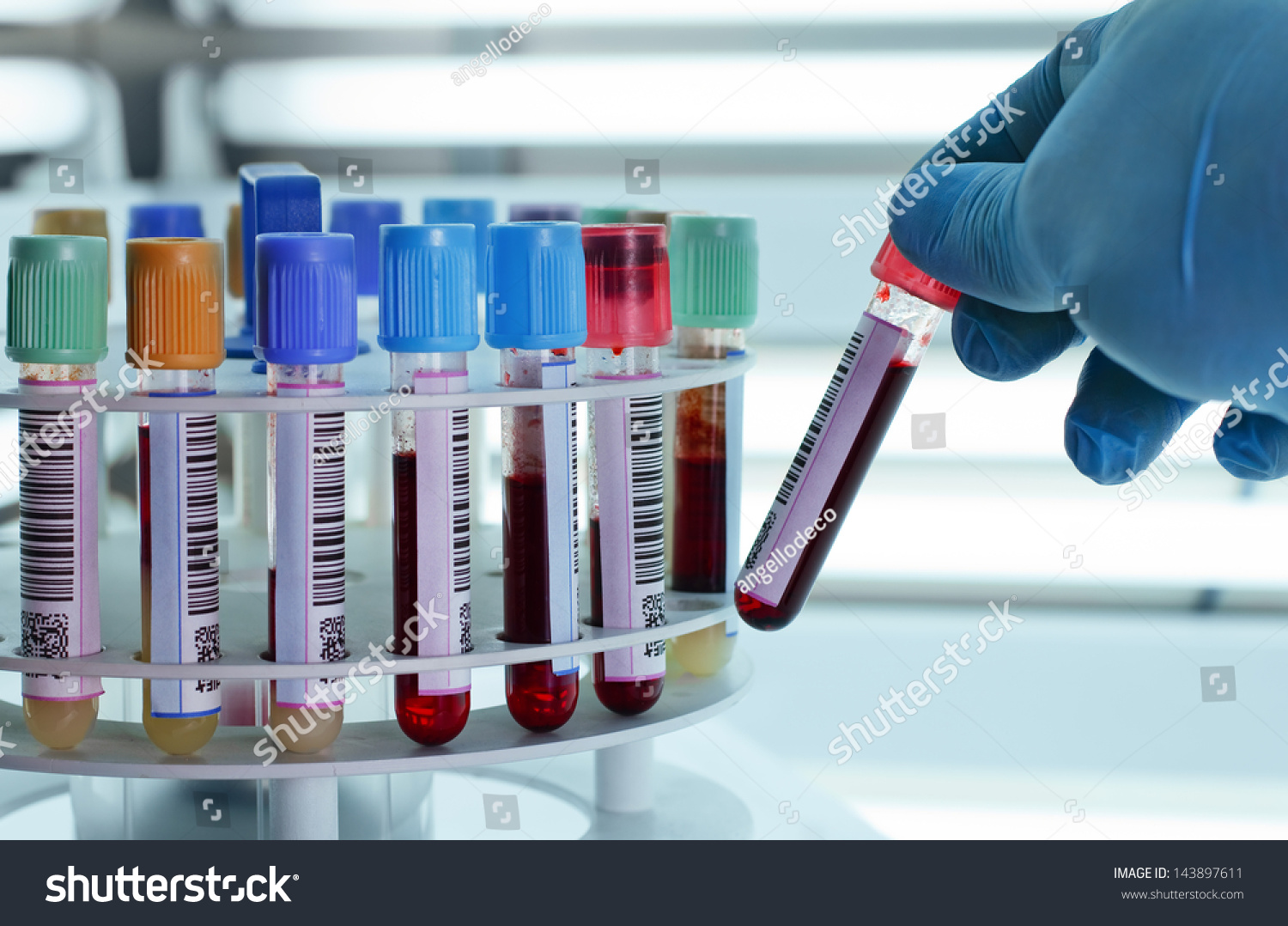 Technician Placing Blood Tubes Laboratory Centrifuge Stock Photo ...