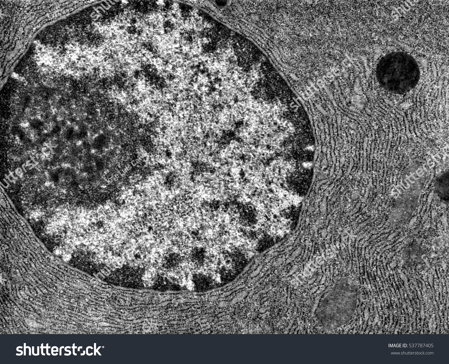 Tem Showing Nucleus Proteinsynthesizing Cell Nuclear Stock Photo ...