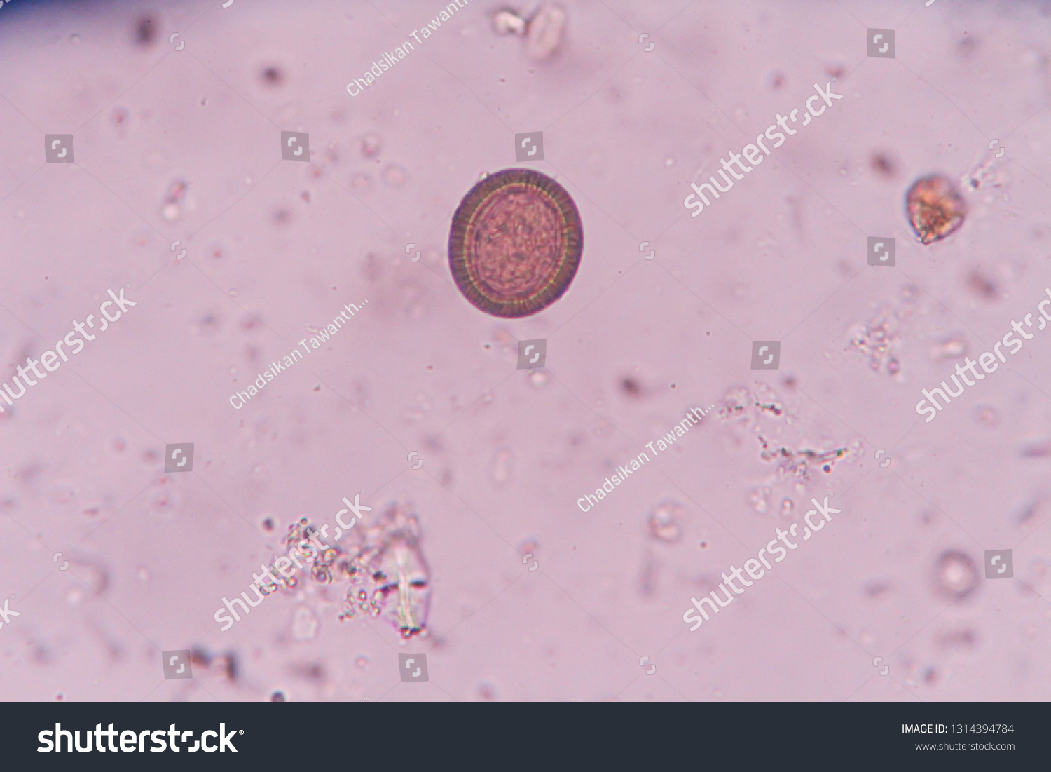 Tenia Spp Stool Under Microscope Stock Photo (Edit Now) 1314394784