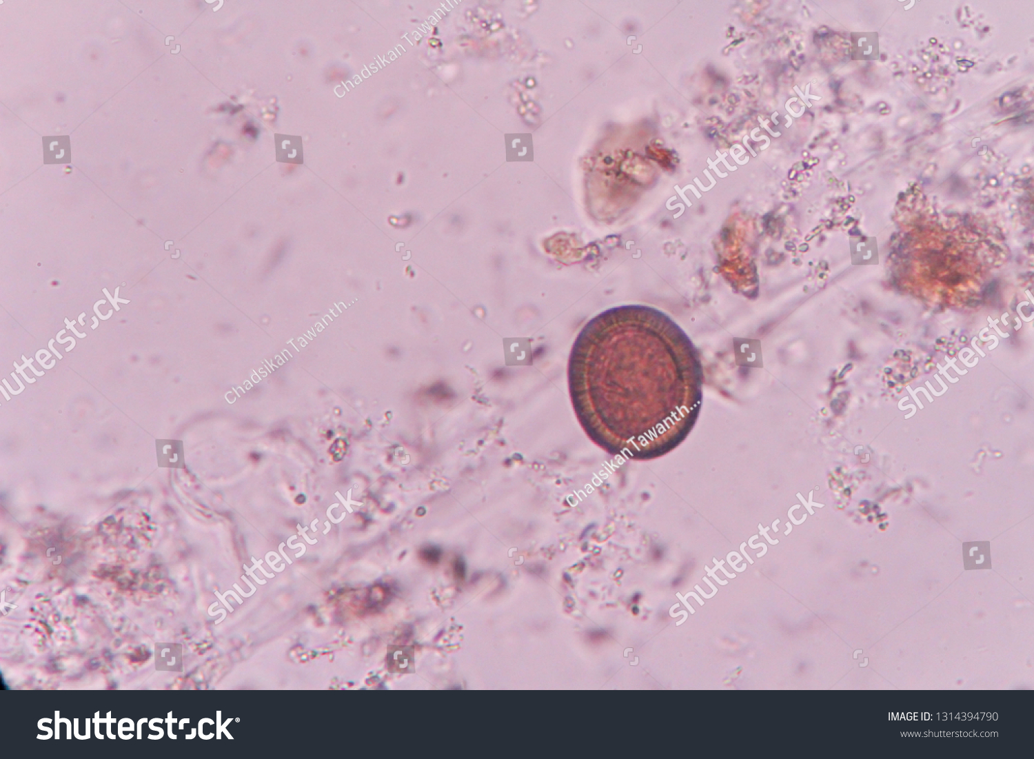 Tenia Spp Stool Under Microscope Stock Photo 1314394790 | Shutterstock