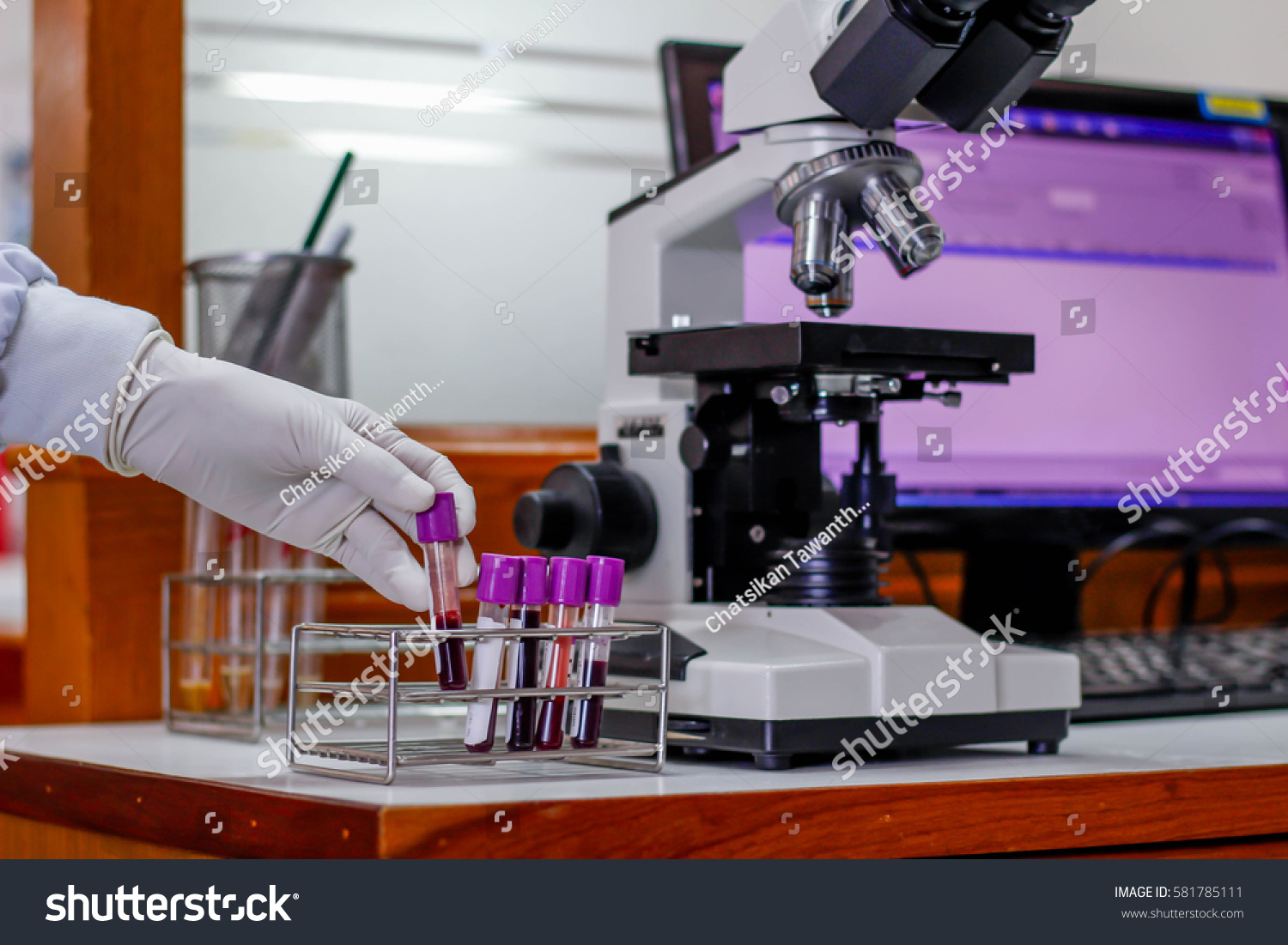 Twinzone kit lee kat lee porn Stock photo the blood in edta tube for test complete blood count testing hematology laboratory