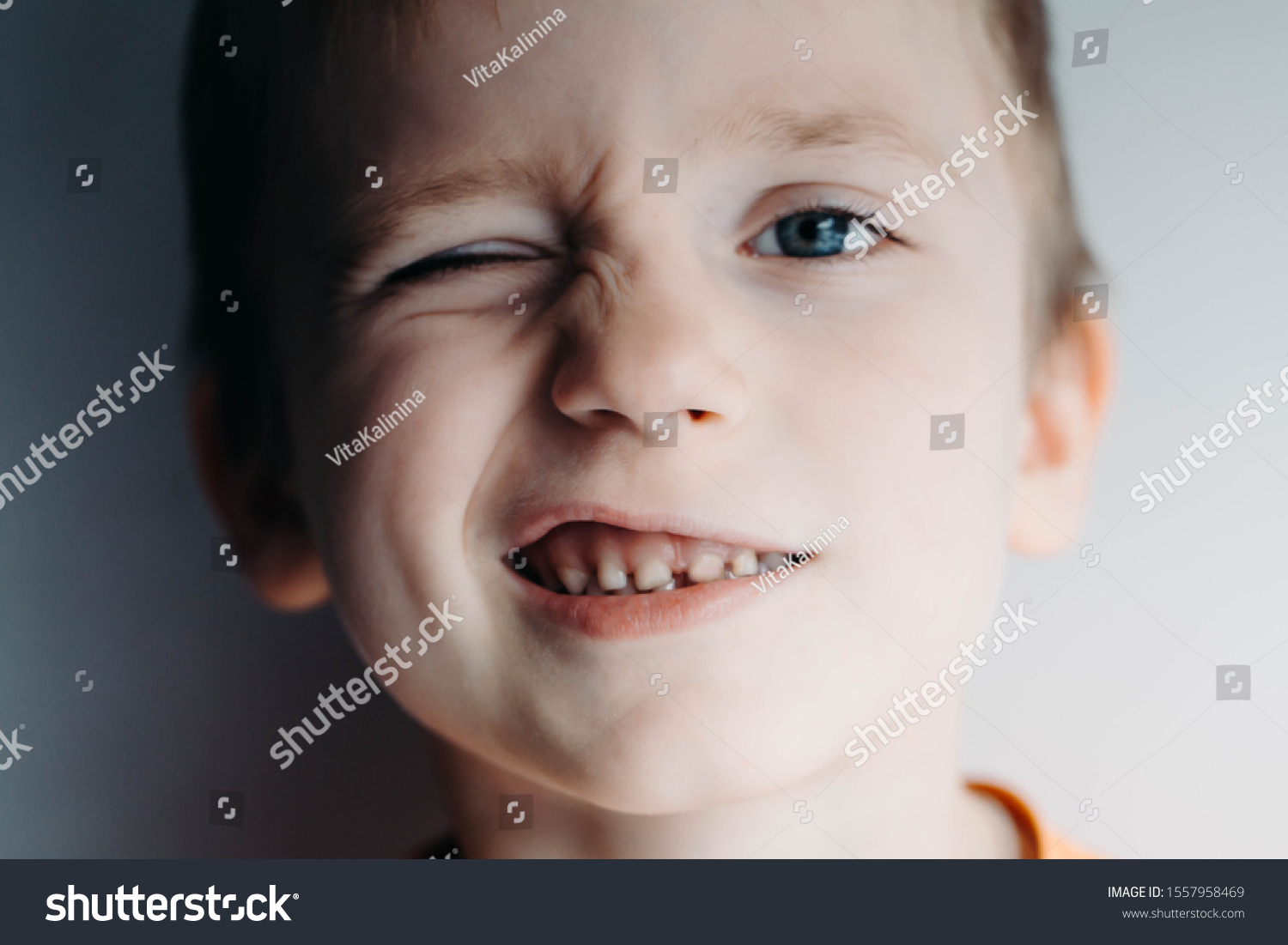 Boy Closes One Eye Squinting Looks 스톡 사진 1557958469 Shutterstock