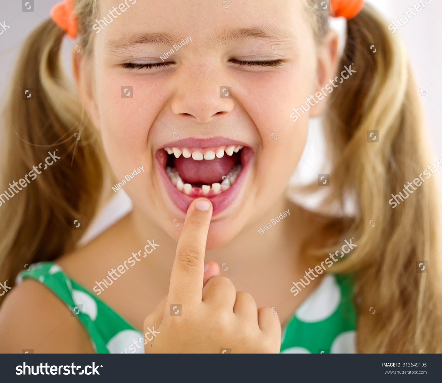 The Child Dropped The First Milk Tooth Stock Photo 313649195 Shutterstock