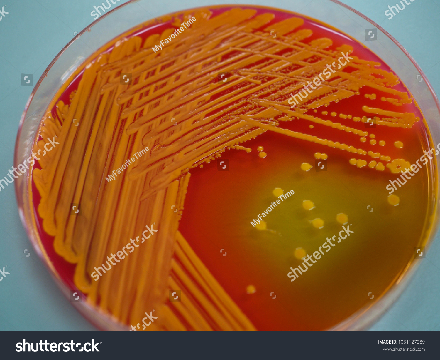 Colony Enteric Bacteria On Xylose Lysine Stock Photo (Edit Now) 1031127289