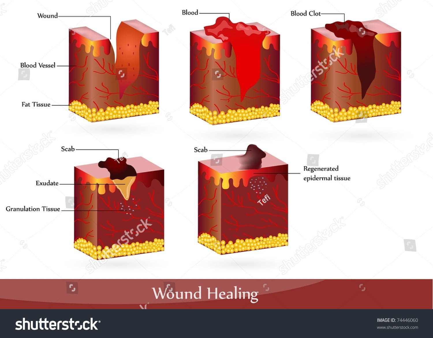 Process Wound Healing Illustration Showing Skin Stock