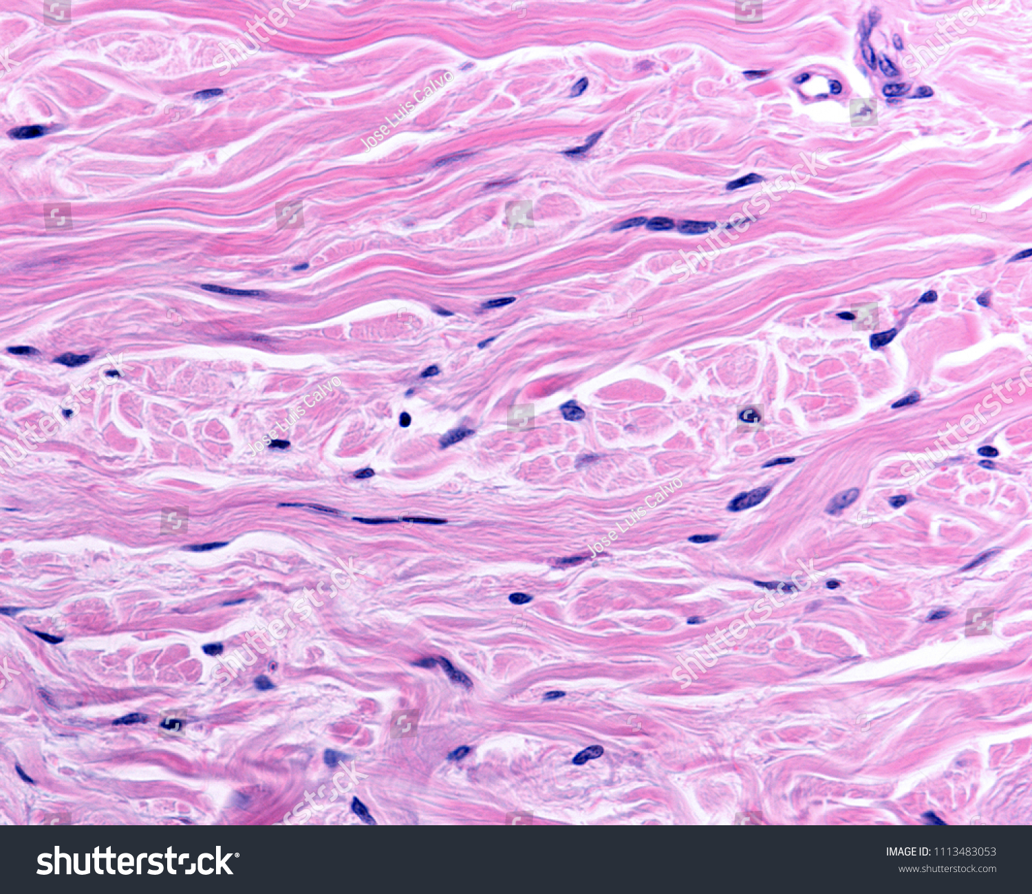 Reticular Dermis Dense Irregular Connective Tissue Stock Photo Edit Now 1113483053