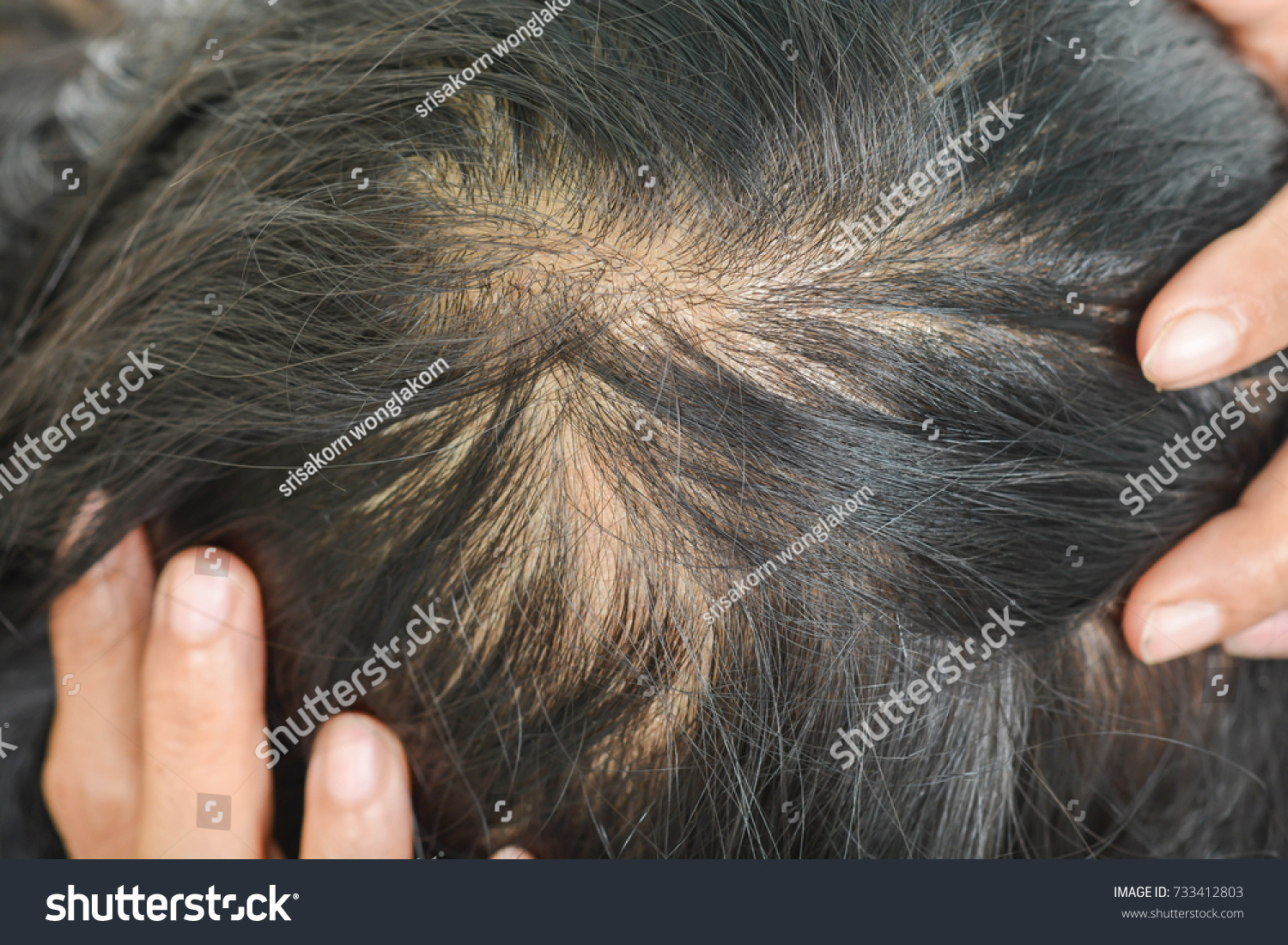 Thin Hair Women Stock Photo 733412803 Shutterstock