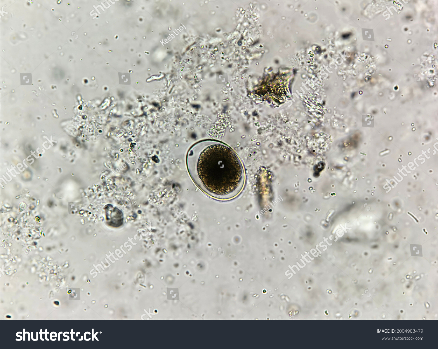 This Hookworm Egg By Microscopic Causing Stock Photo 2004903479 ...