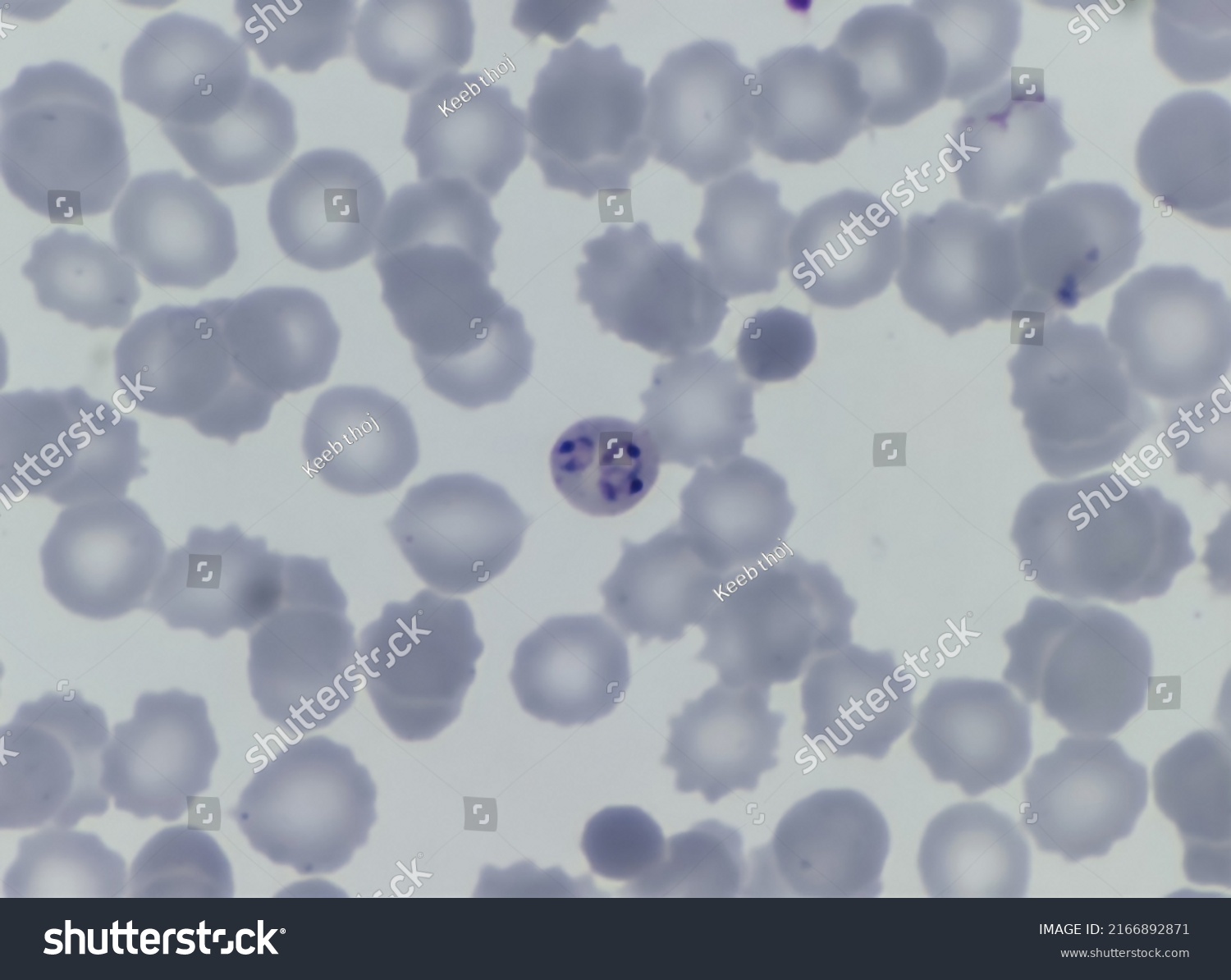 This Plasmodium Falciparum Ring Form Stage Stock Illustration ...