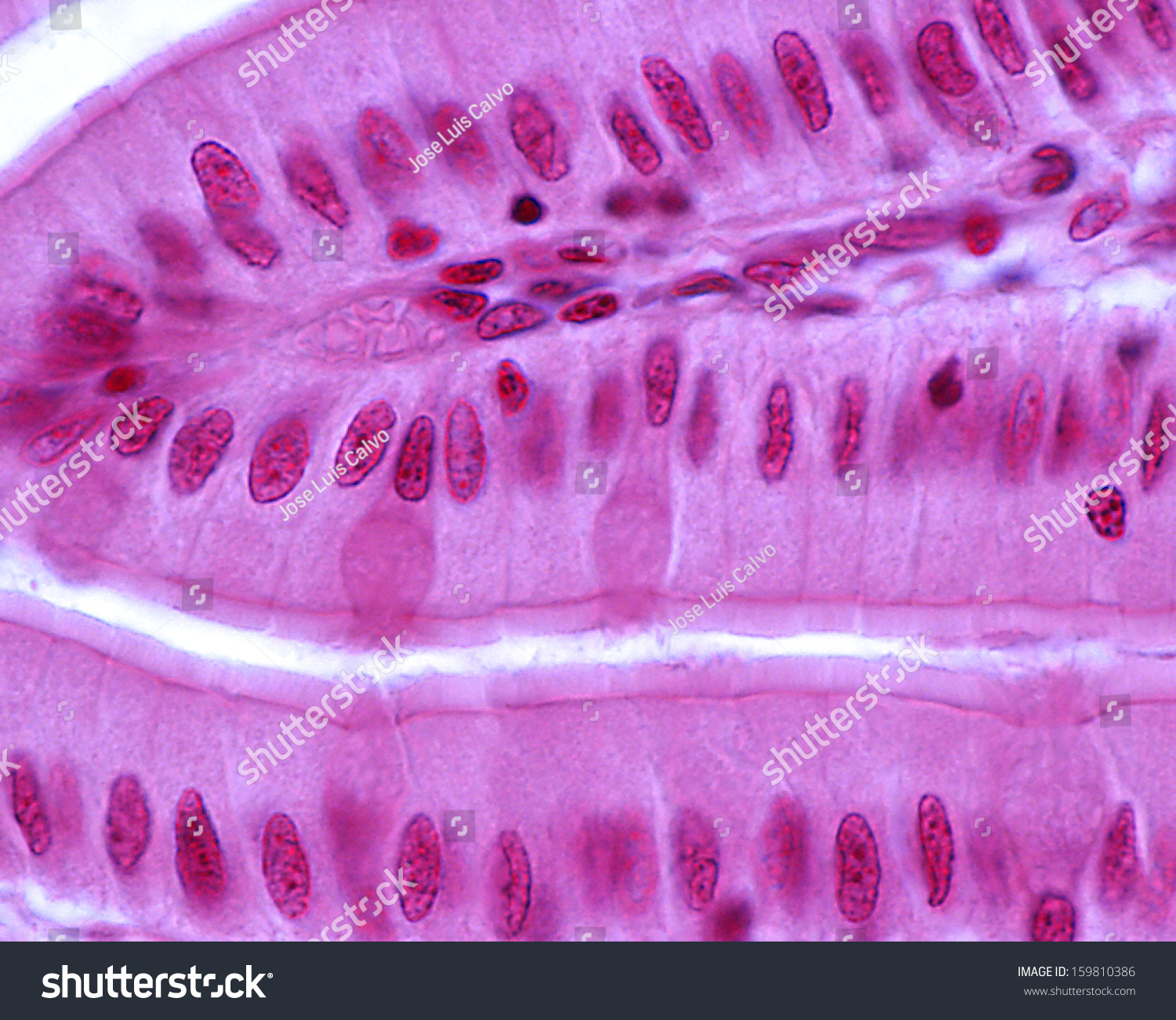 Tip Intestinal Villus Seen Light Microscope Stock Photo 159810386 ...