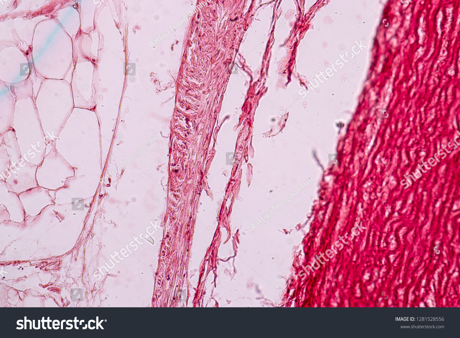 Tissue Arteries Veins Under Microscopic Physiology Stock Photo (Edit ...