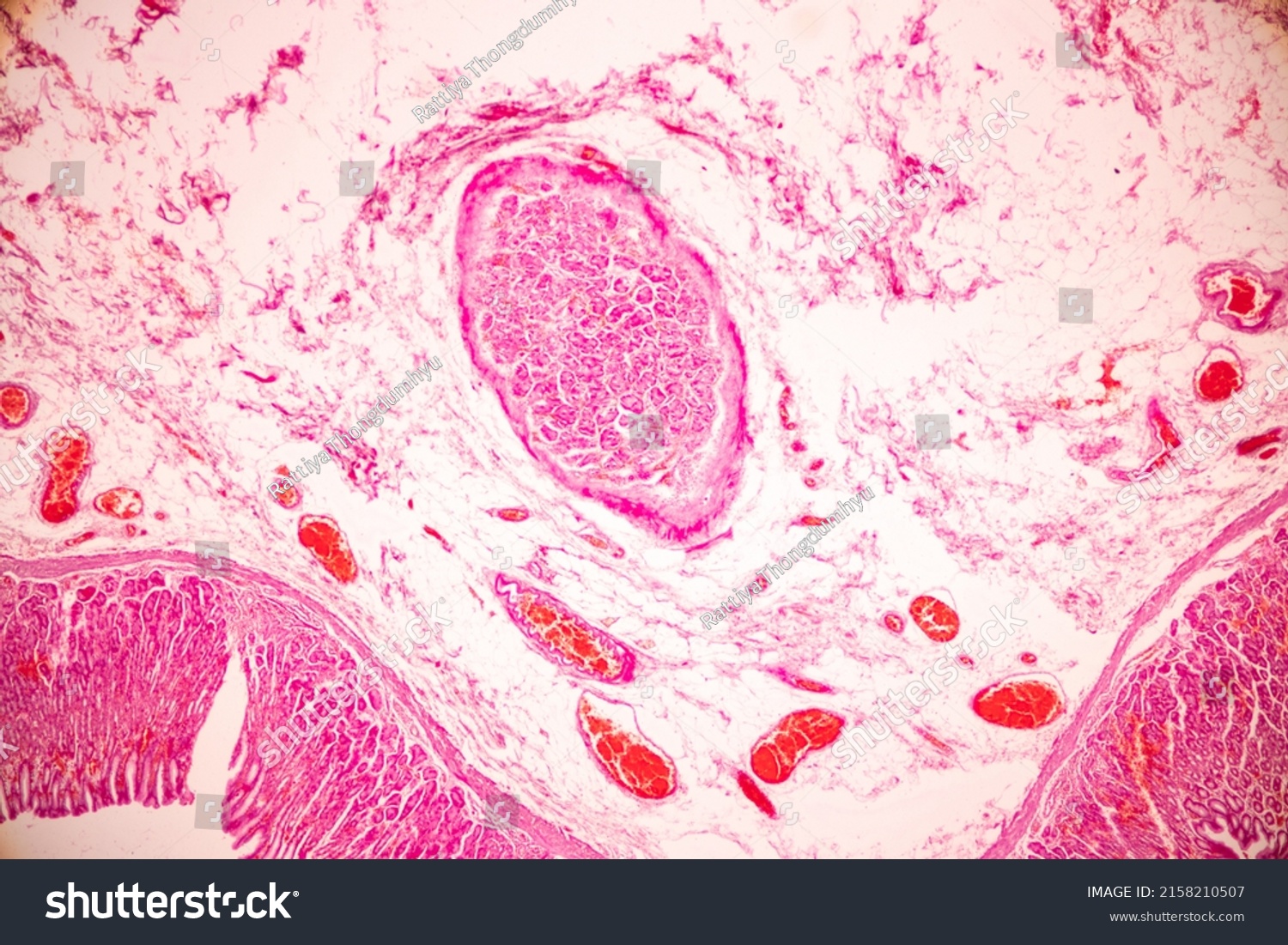 Tissue Stomach Human Under Microscope Lab Stock Photo 2158210507 