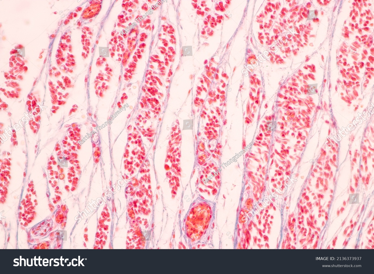 Tooth Development Human Under Microscope View Stock Photo 2136373937 ...