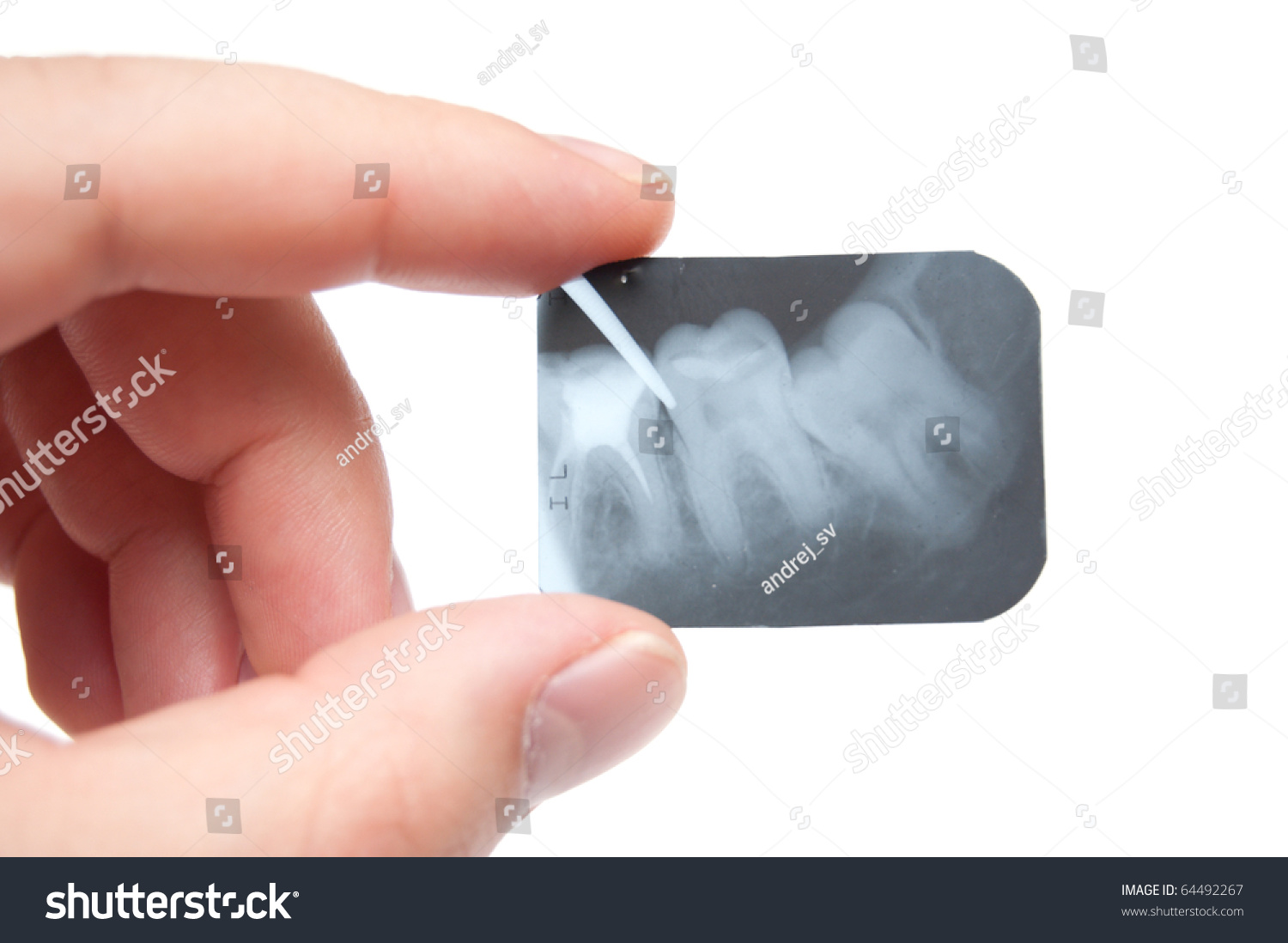 Tooth X-Ray In The Hand Stock Photo 64492267 : Shutterstock