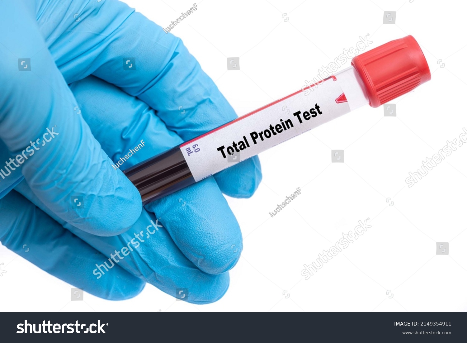 Total Protein Test Medical Check Test Stock Photo 2149354911 | Shutterstock