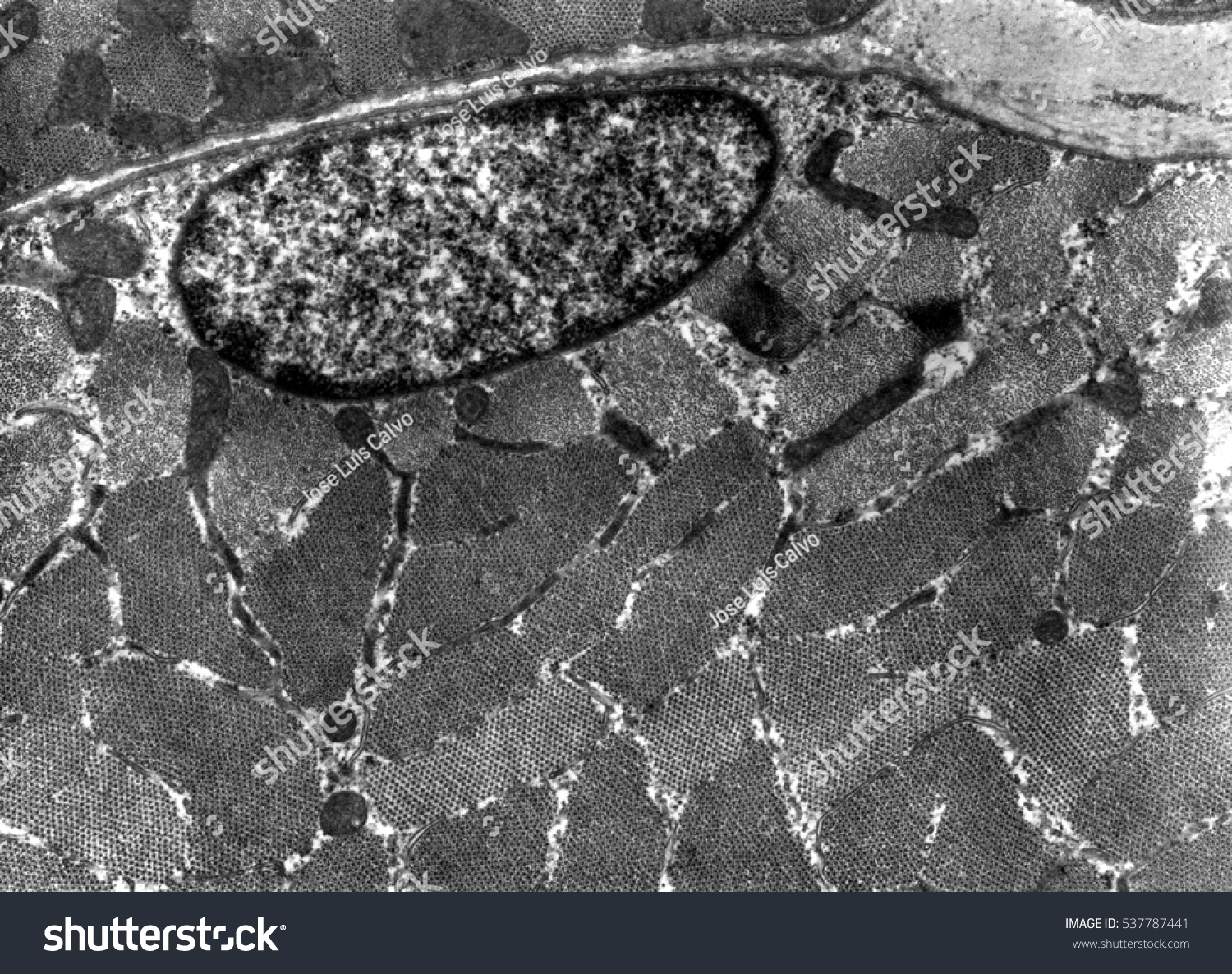 Transmission Electron Micrograph Tem Showing Striated Stock Photo ...