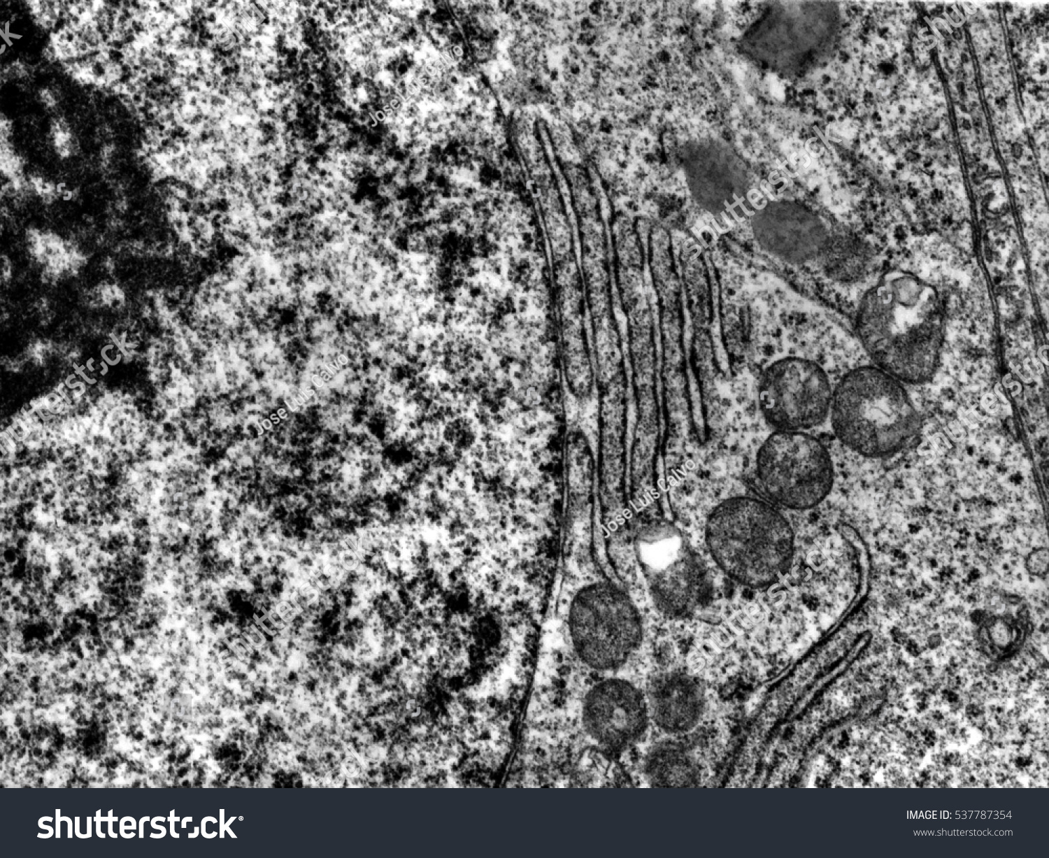 Rough Endoplasmic Reticulum Electron Micrograph