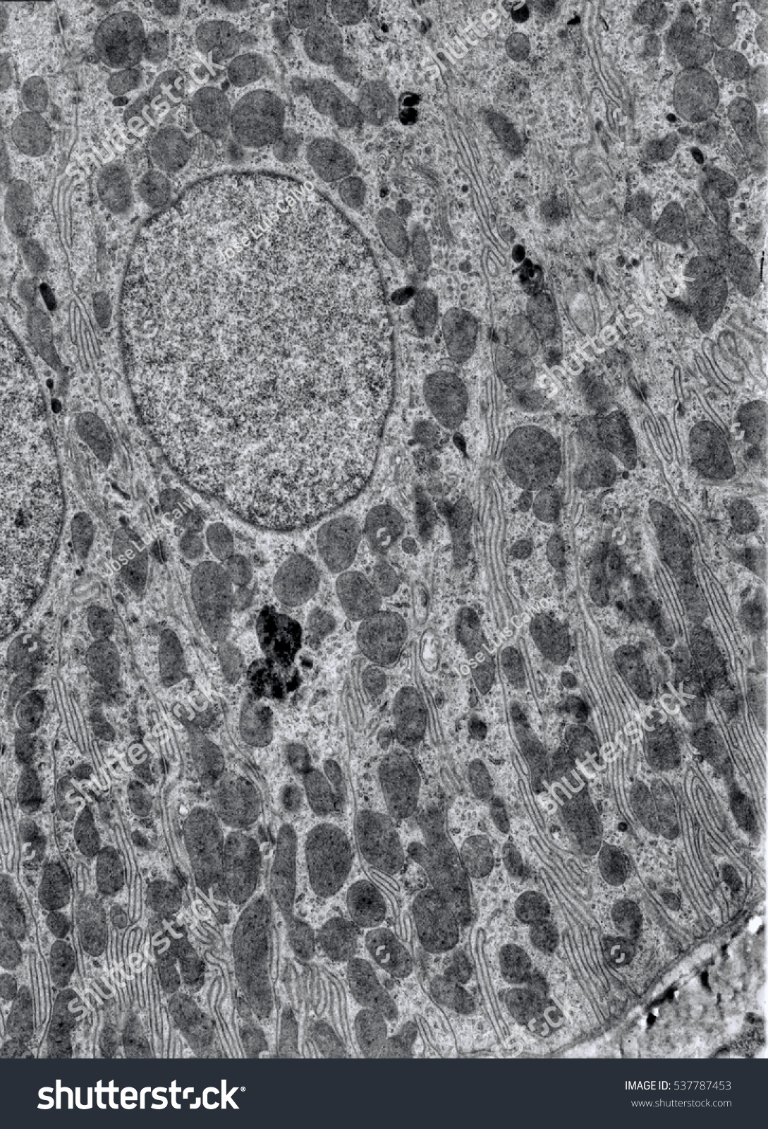 Transmission Electron Microscope Tem Micrograph Showing Stock Photo Edit Now Transmission Electron Microscope Tem Micrograph Showing Stock Photo Edit Now