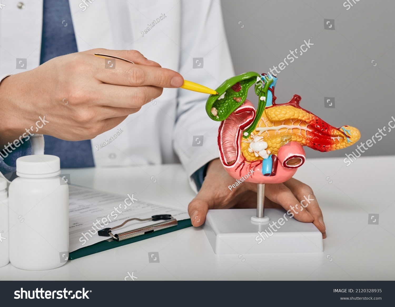 Cholelithiasis Stock Photos, Images & Photography | Shutterstock