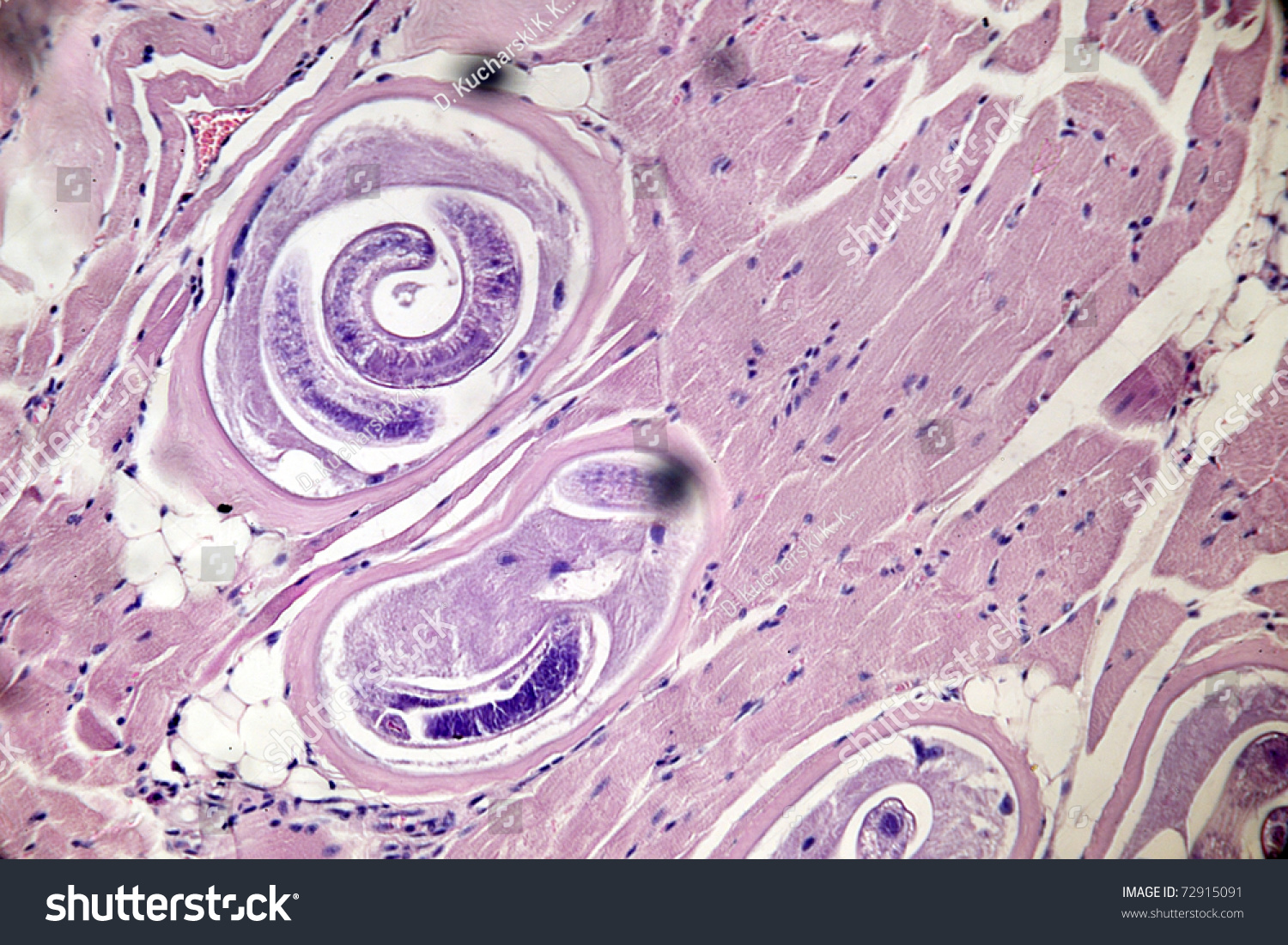 Light Micrograph Of Muscle With Encysted Trichinella