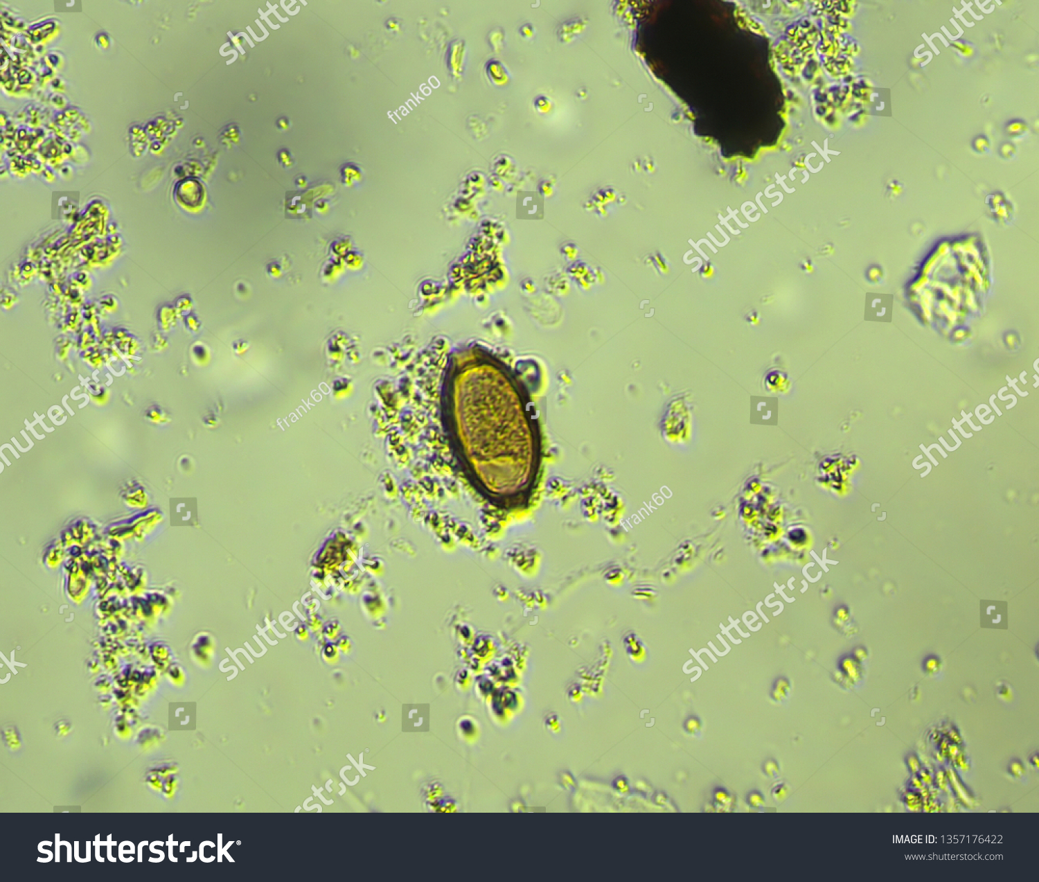 Trichuris Trichiura Egg Parasite Stool Exam Stock Photo (edit Now 