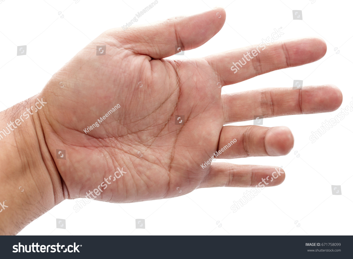 Trigger Finger On Ring Finger Mans Stock Photo 671758099 - Shutterstock