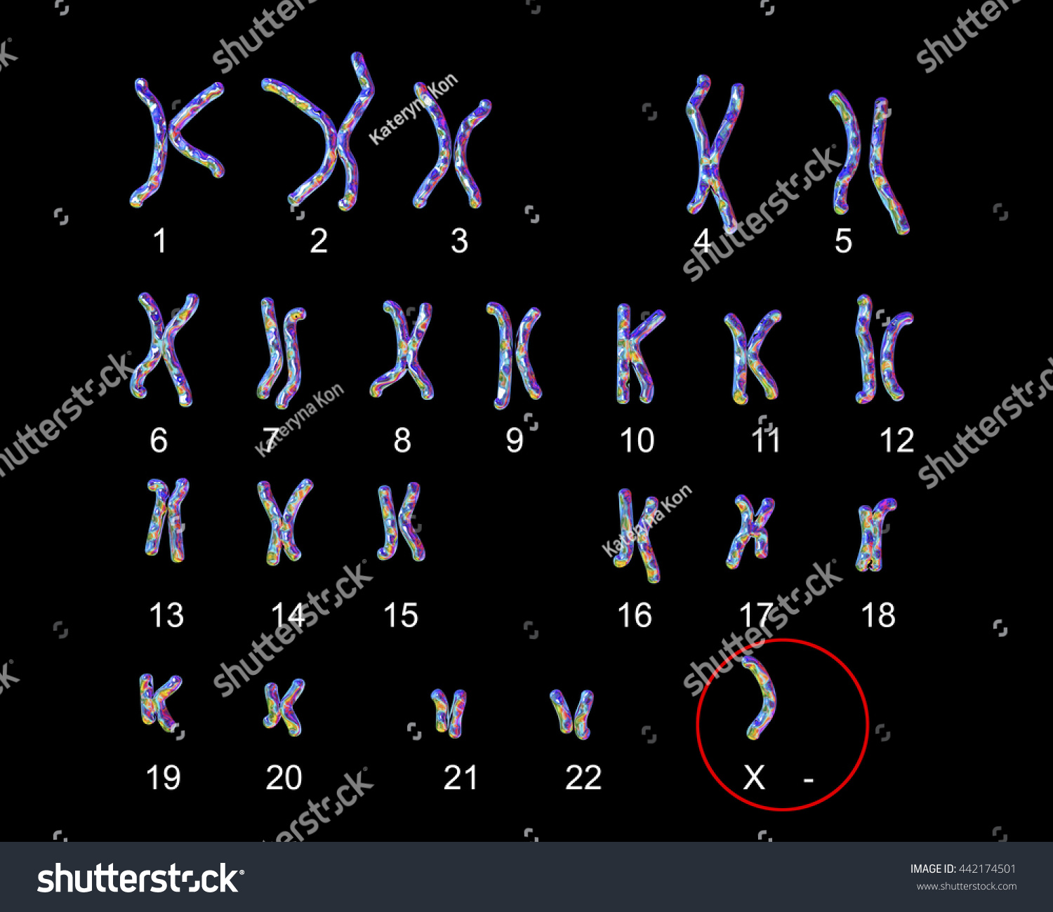 Turnerssyndrome Karyotype Labeled X Karyotype D Stock Illustration