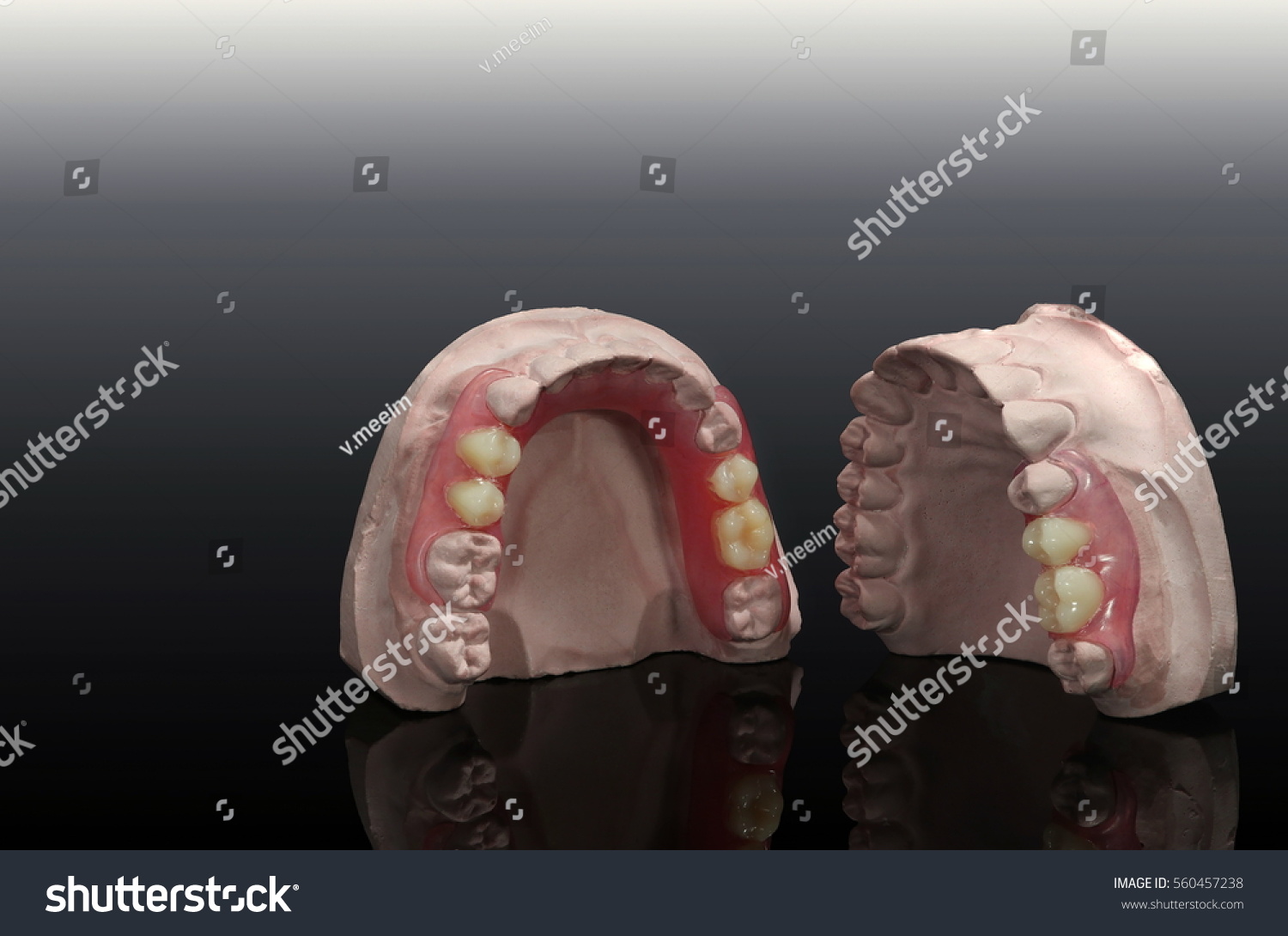 Two Temporaryplate Denture Stock Photo 560457238 Shutterstock