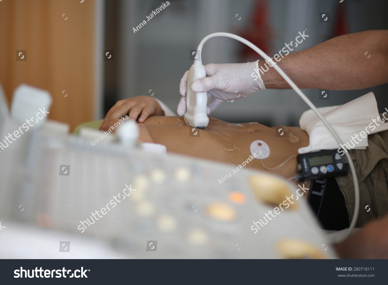Ultrasound Imaging Abdomen Stock Photo 280718111 - Shutterstock