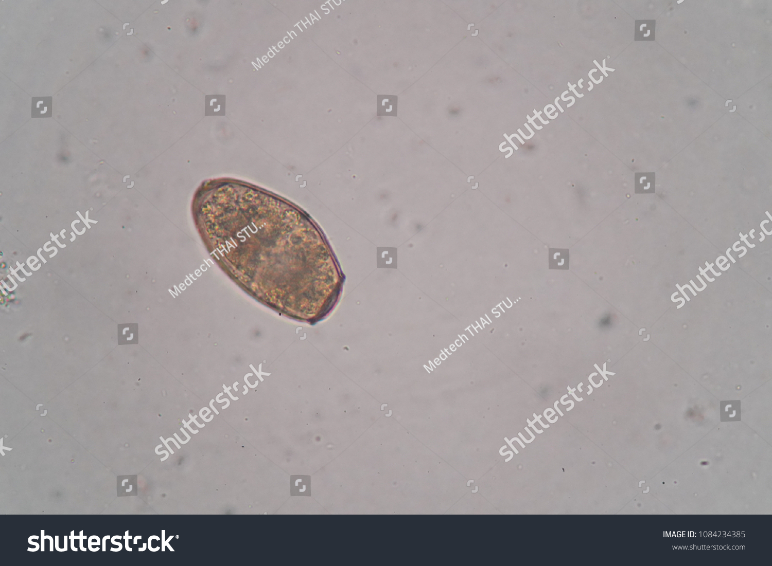 Under Microscopy Showing Paragonimus Westermani Egg Stock Photo ...