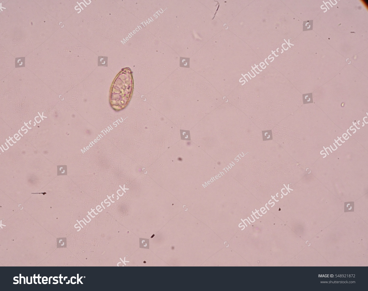 Under Microscopy Showing Trematodes (Flukes) Opisthorchis Viverrini Egg ...