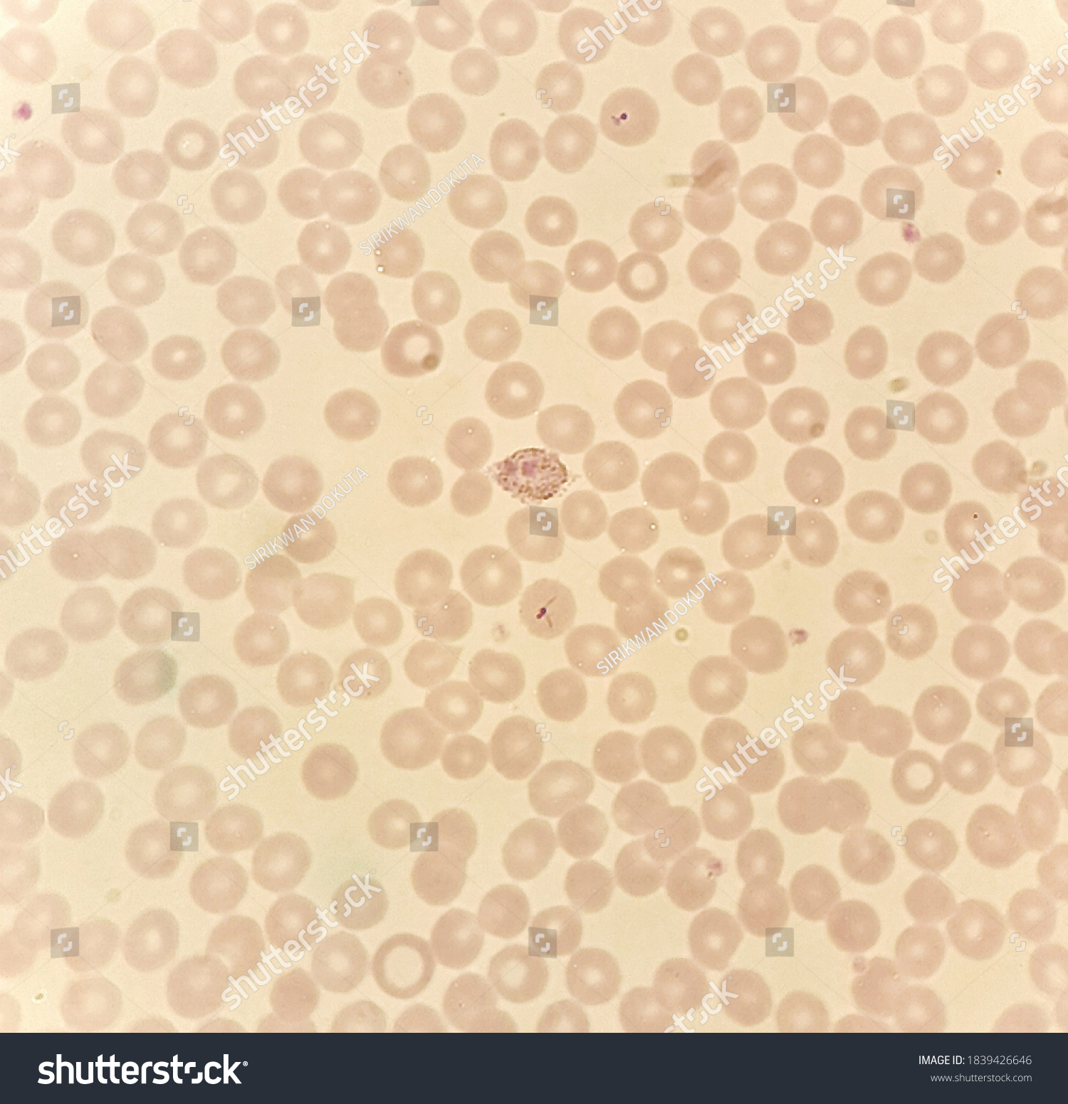 Under X Light Microscope Human Parasite Stock Photo Edit Now