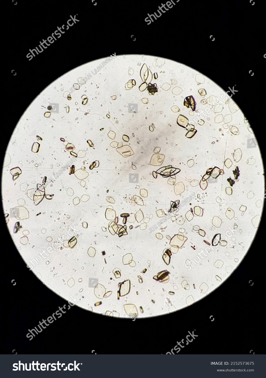 Uric Acid Crystals Urine Microscopy Stock Illustration 2152573675 Shutterstock 1759