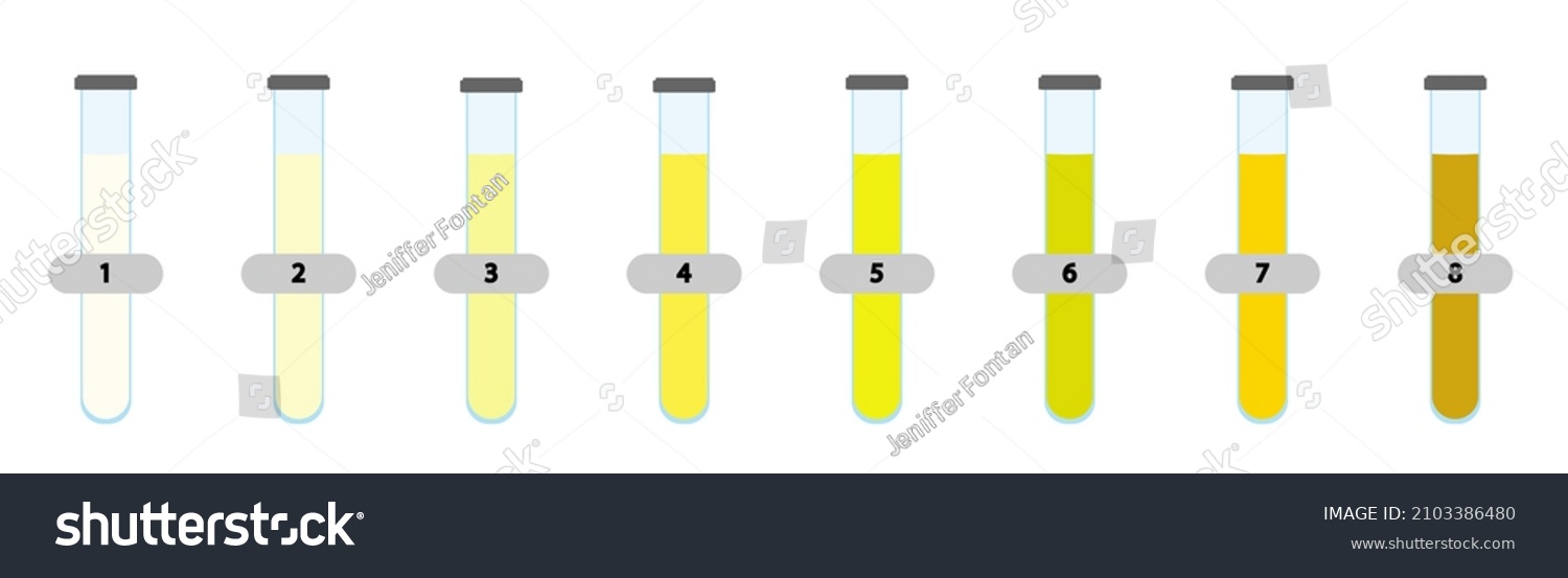 Urine Color Scale Chart Scale Analyse Stock Illustration 2103386480