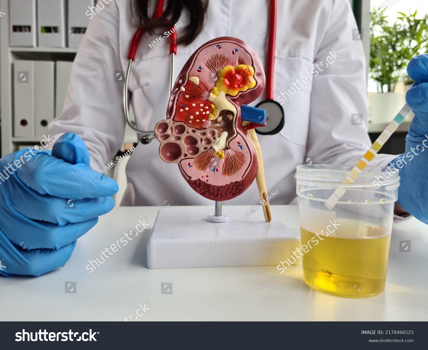 Urologist Doctor Makes Express Urine Test Stock Photo 2178466525 Shutterstock Urologist Doctor Makes Express Urine Test Stock Photo 2178466525 Shutterstock