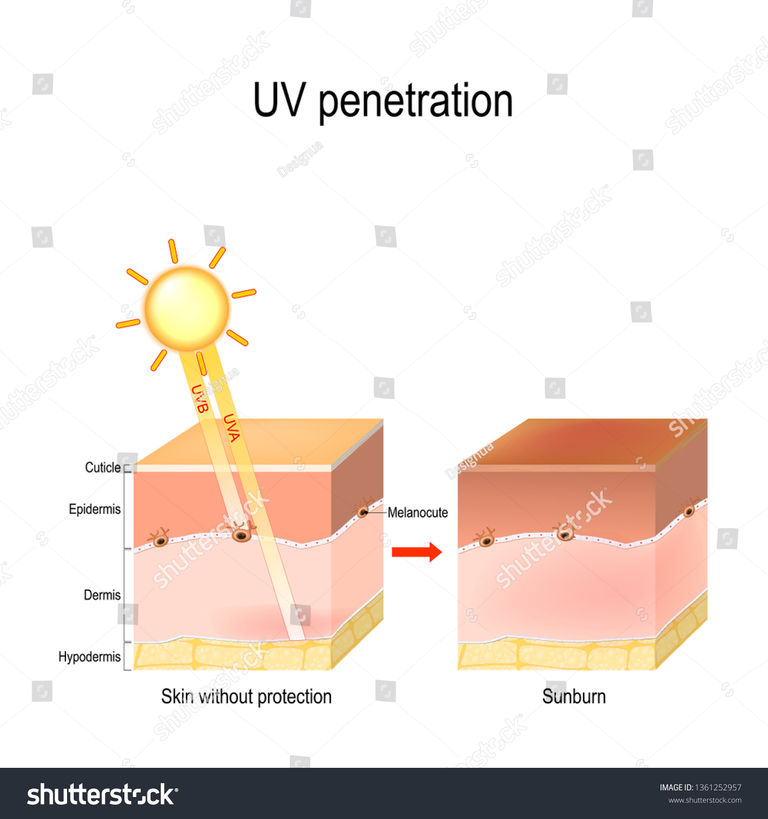 Uv Penetration Into Layers Human Skin Stock Illustration 1361252957