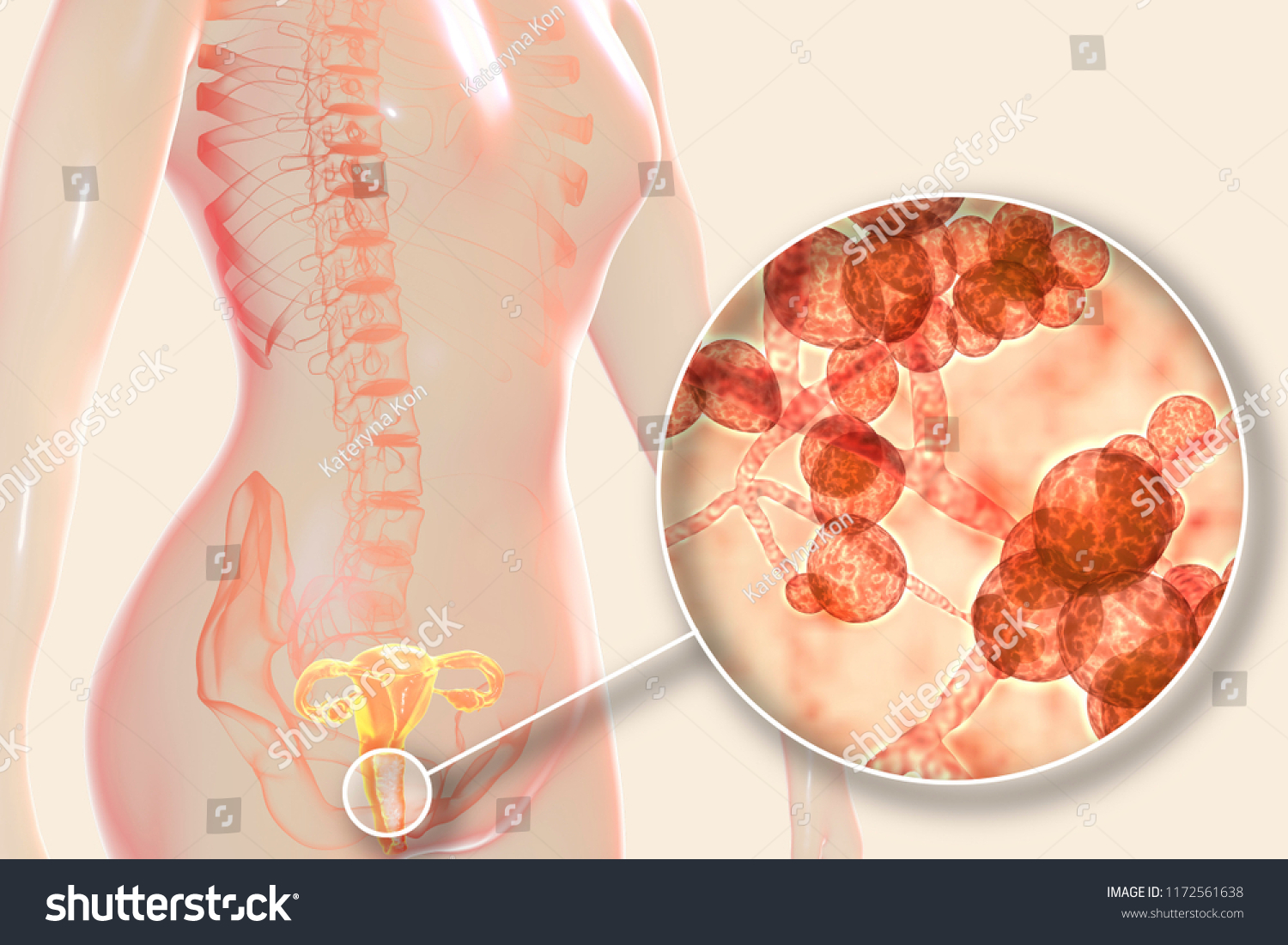 Vaginal Thrush Female Candidiasis 3d Illustration ilustrações stock