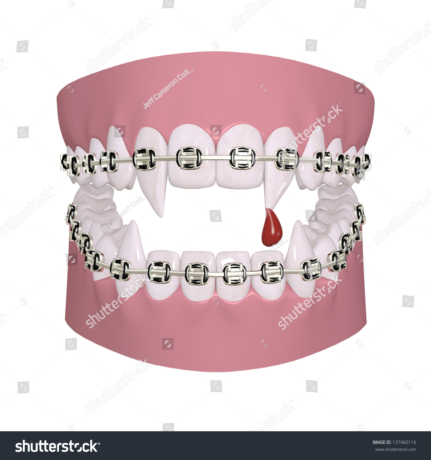 Vampire Braces Set Gums Vampire Teeth Stock Illustration 137460116