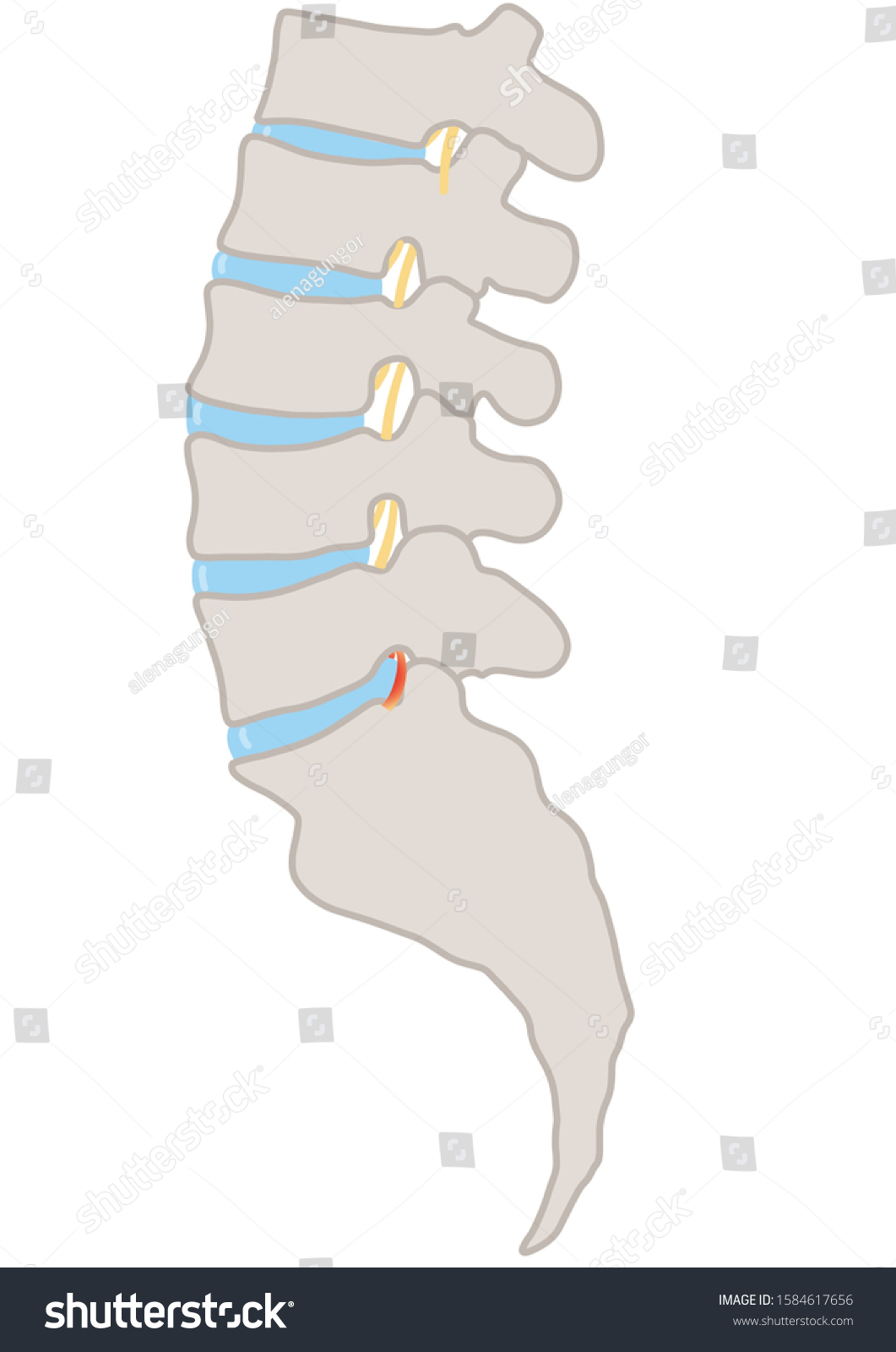 Various Spinal Problems Presented Here Such Stock Illustration ...