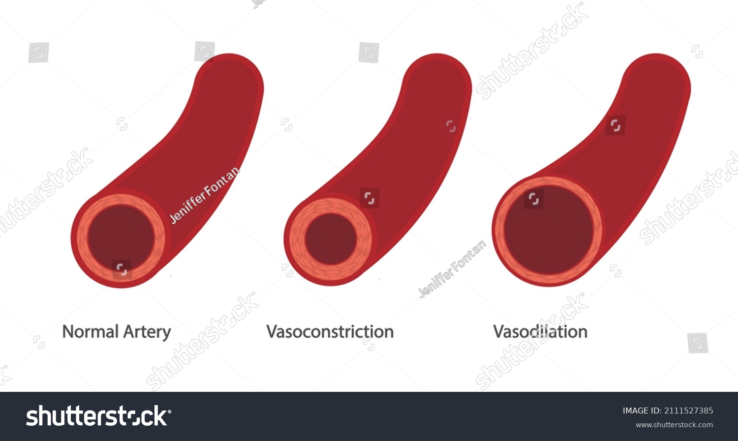 Vasodilation Vasoconstriction Illustration Different Thickness Artery ...