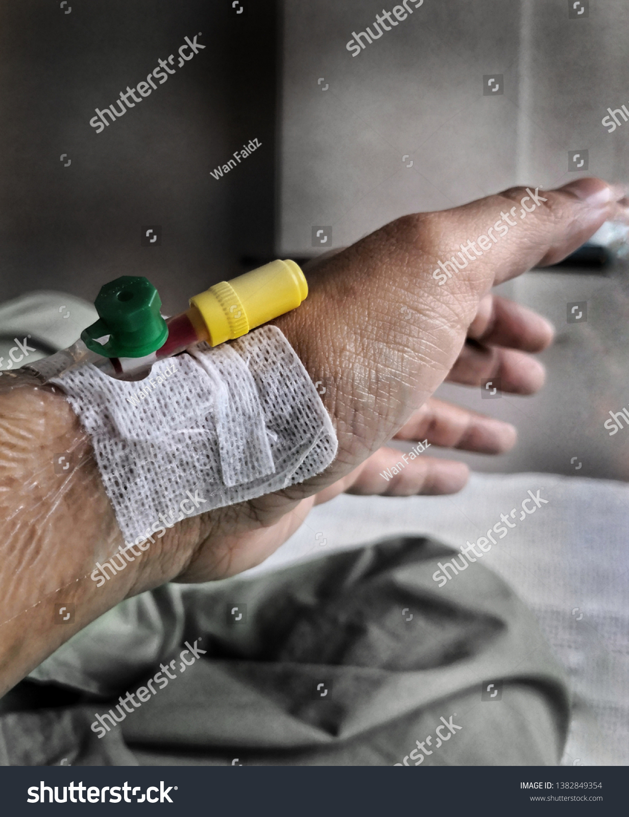 Download View Cannula Branula Green Yellow Colours Stock Photo Edit Now 1382849354 PSD Mockup Templates